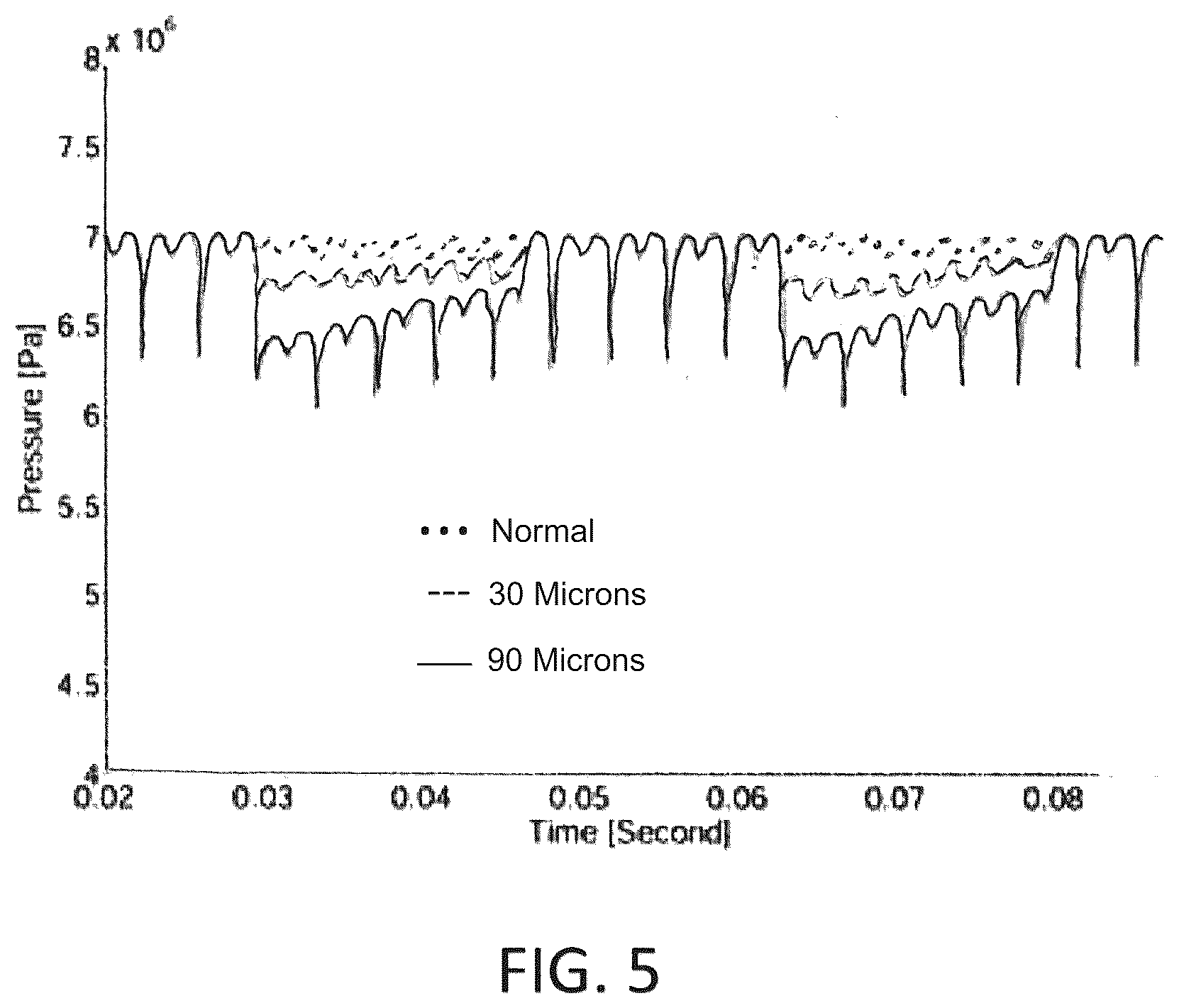 Patent US12480579 Figure 5 – Predictive failure system, apparatus and method for hydrostatic transmissions