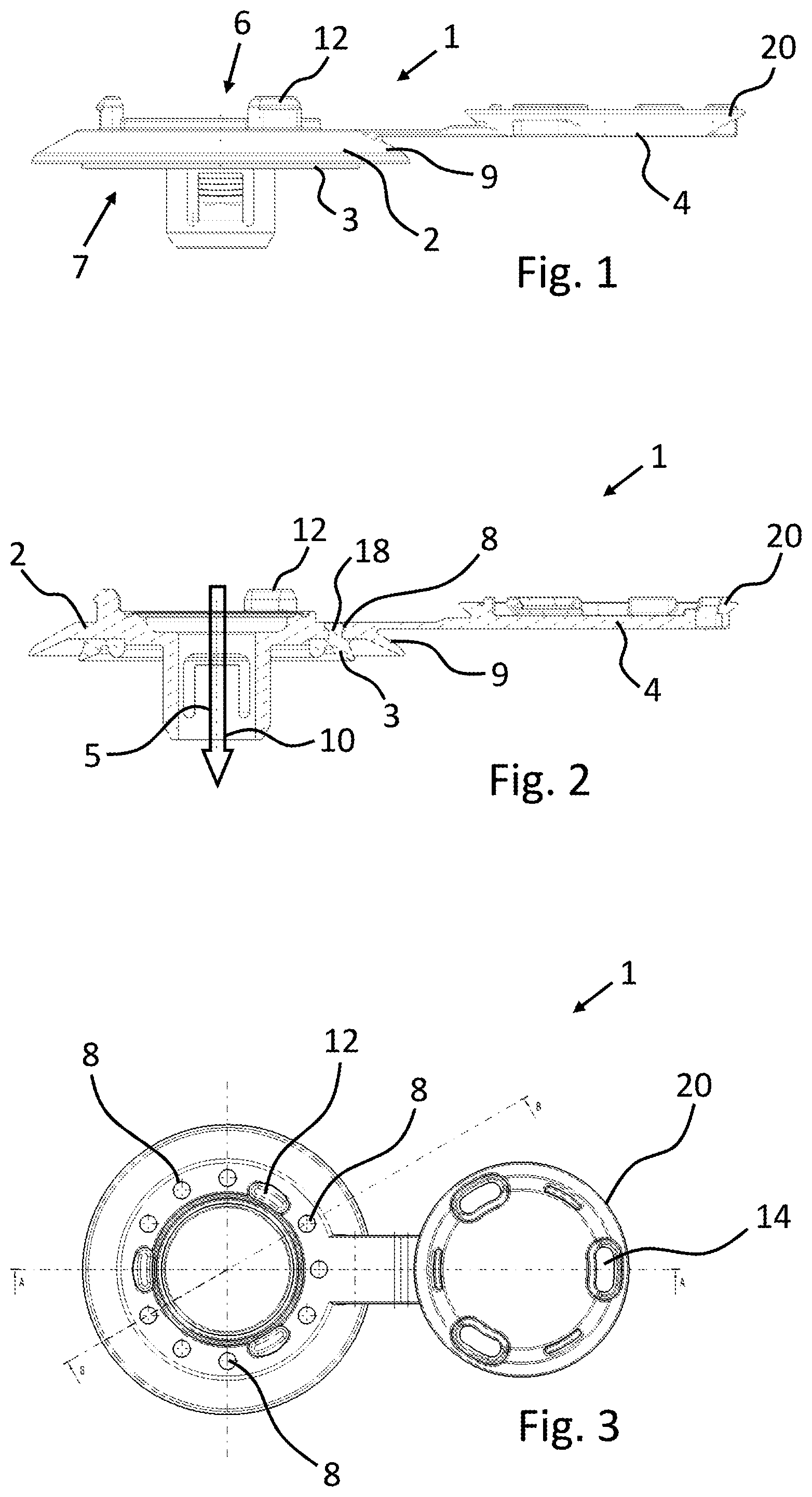 Patent US12480592 Figure 1 – Apparatus for sealingly connecting to an opening of a carrier component