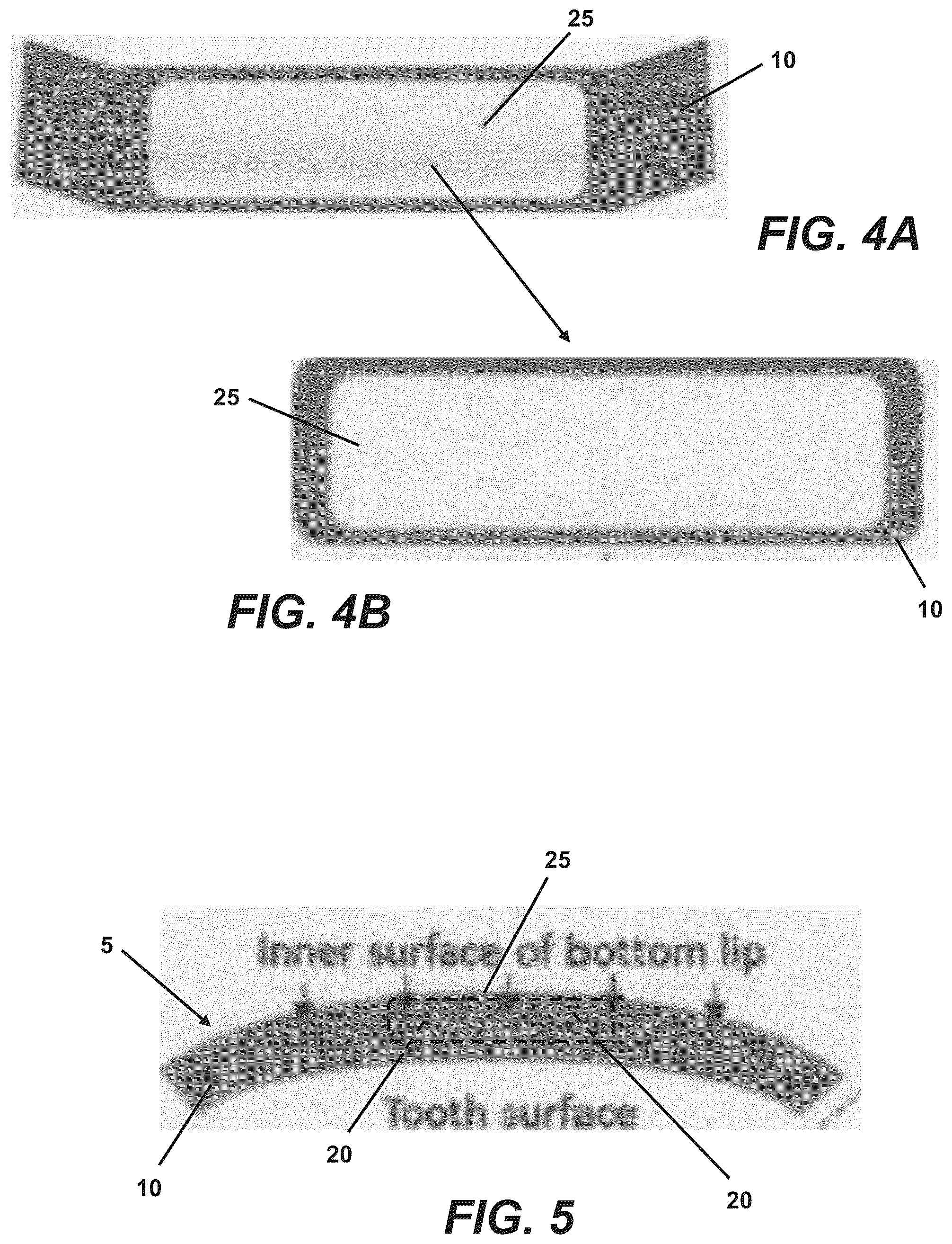 Patent US12480841 Figure 3 – Interstitial fluid capture device and method of measuring electrolyte levels using same