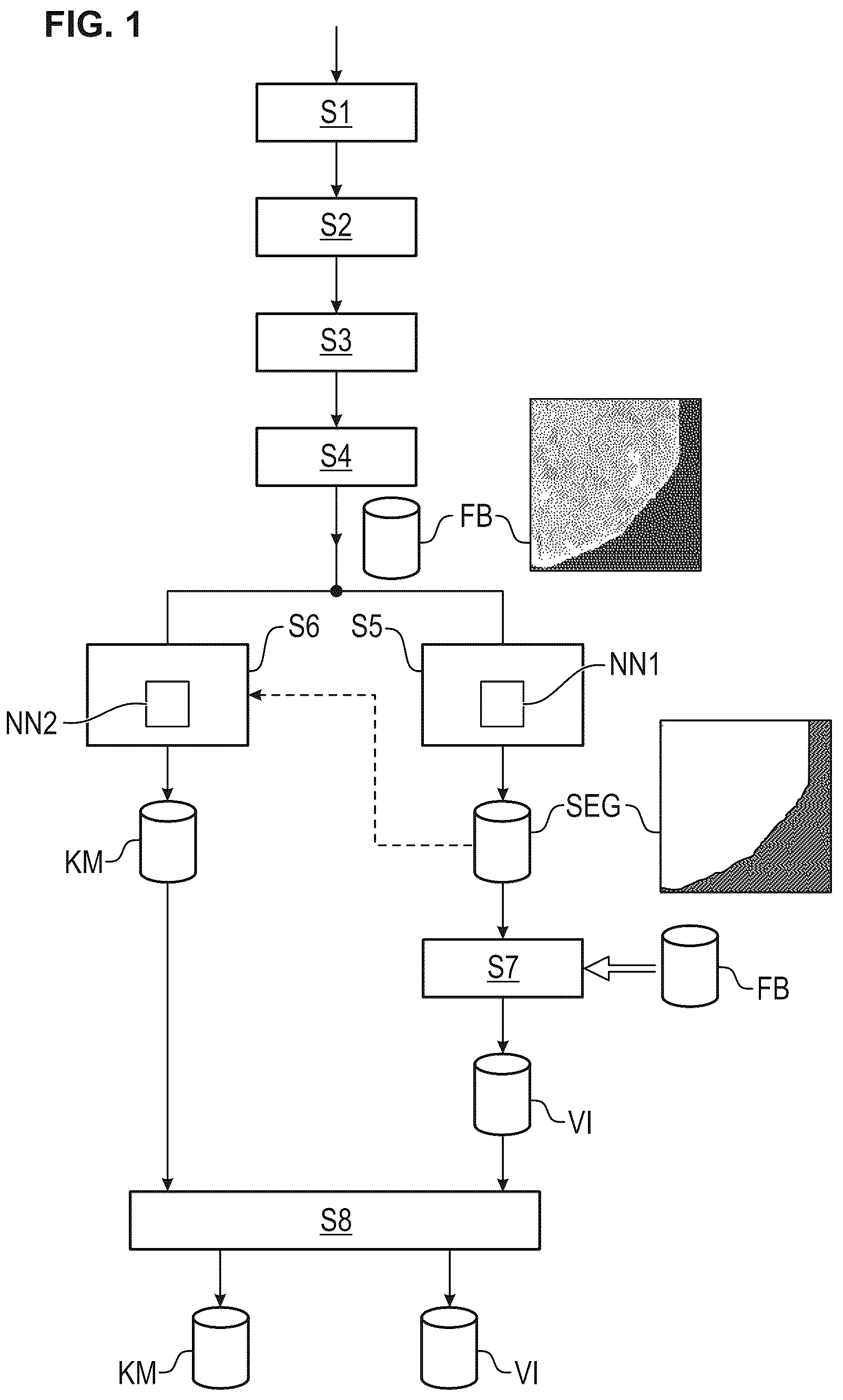 Patent US12480877 Figure 1 – Method and apparatus for detecting a presence of a fluorescence pattern type on an organ section by means of immunofluorescence microscopy