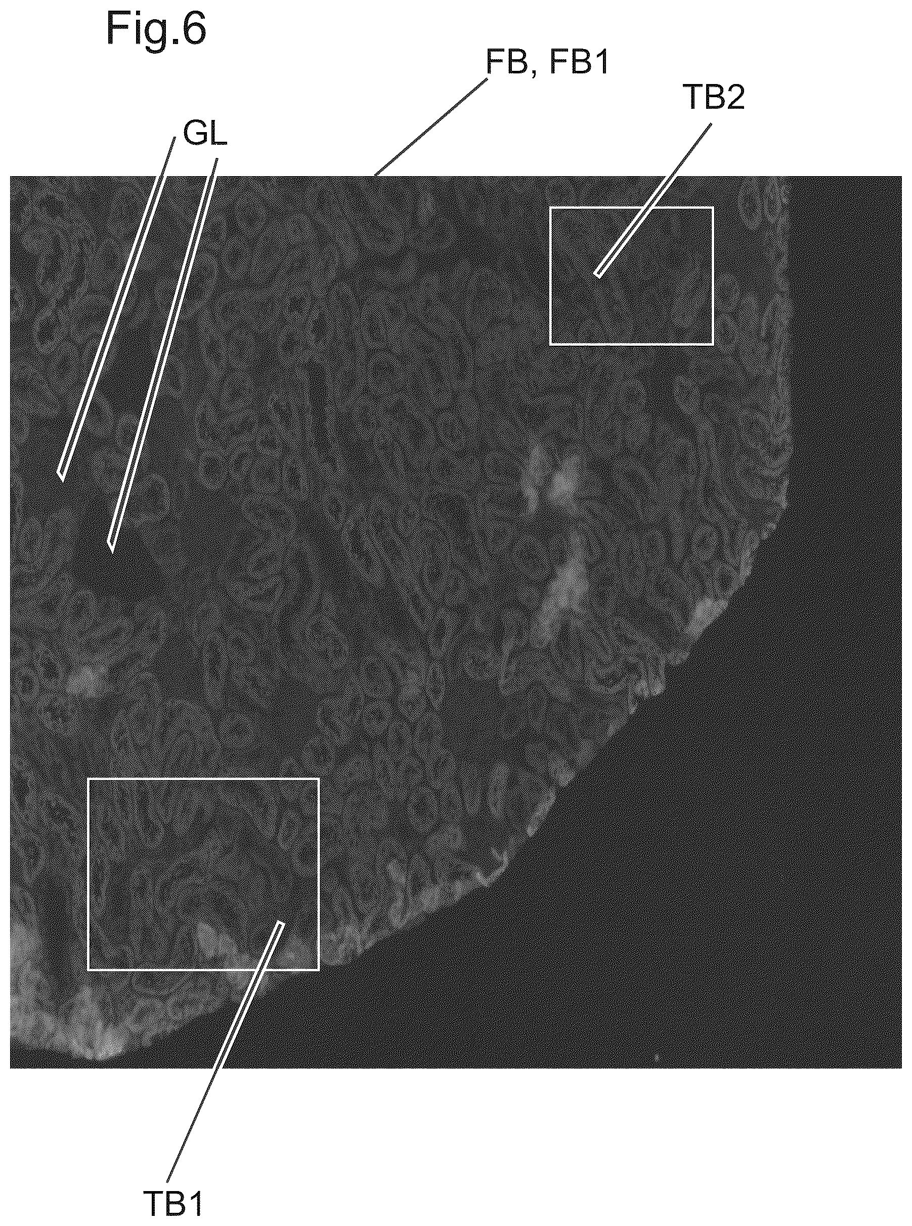 Patent US12480877 Figure 5 – Method and apparatus for detecting a presence of a fluorescence pattern type on an organ section by means of immunofluorescence microscopy