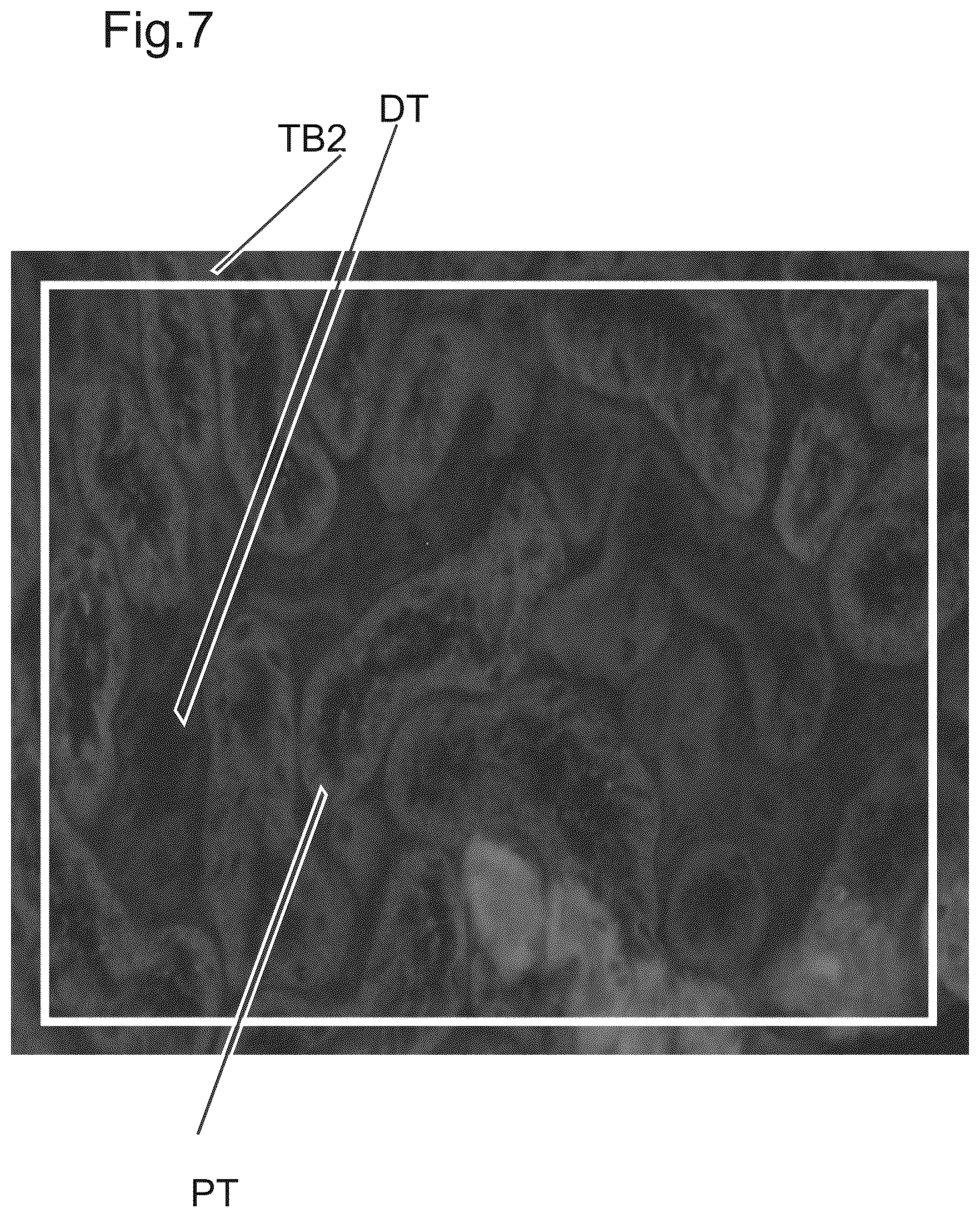 Patent US12480877 Figure 6 – Method and apparatus for detecting a presence of a fluorescence pattern type on an organ section by means of immunofluorescence microscopy