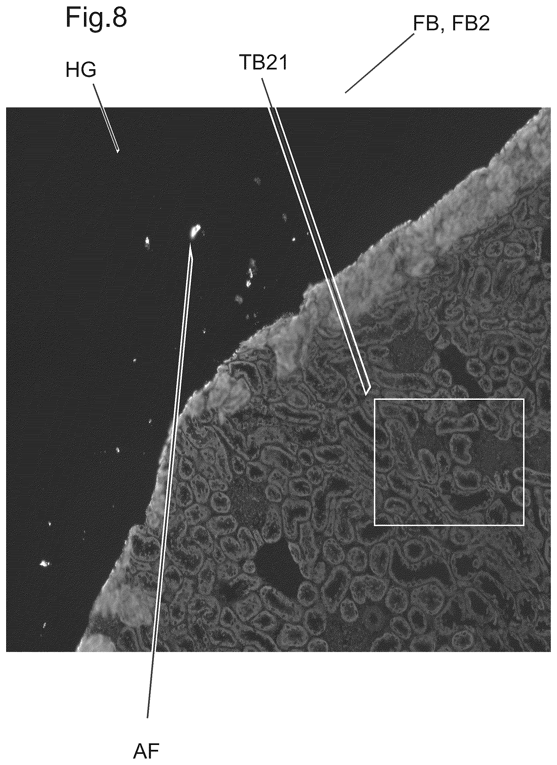 Patent US12480877 Figure 7 – Method and apparatus for detecting a presence of a fluorescence pattern type on an organ section by means of immunofluorescence microscopy