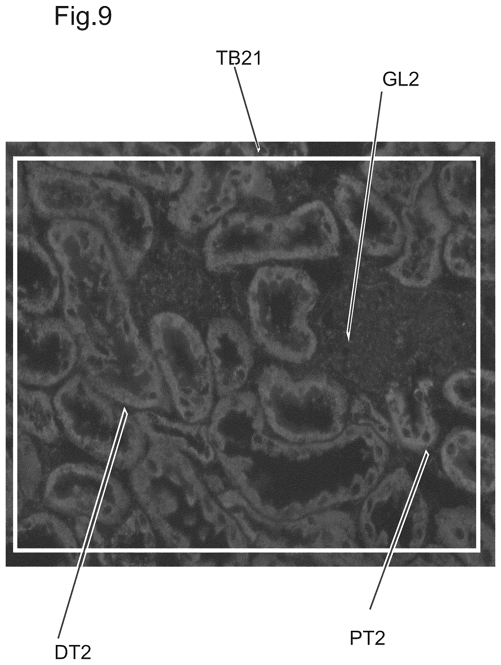 Patent US12480877 Figure 8 – Method and apparatus for detecting a presence of a fluorescence pattern type on an organ section by means of immunofluorescence microscopy
