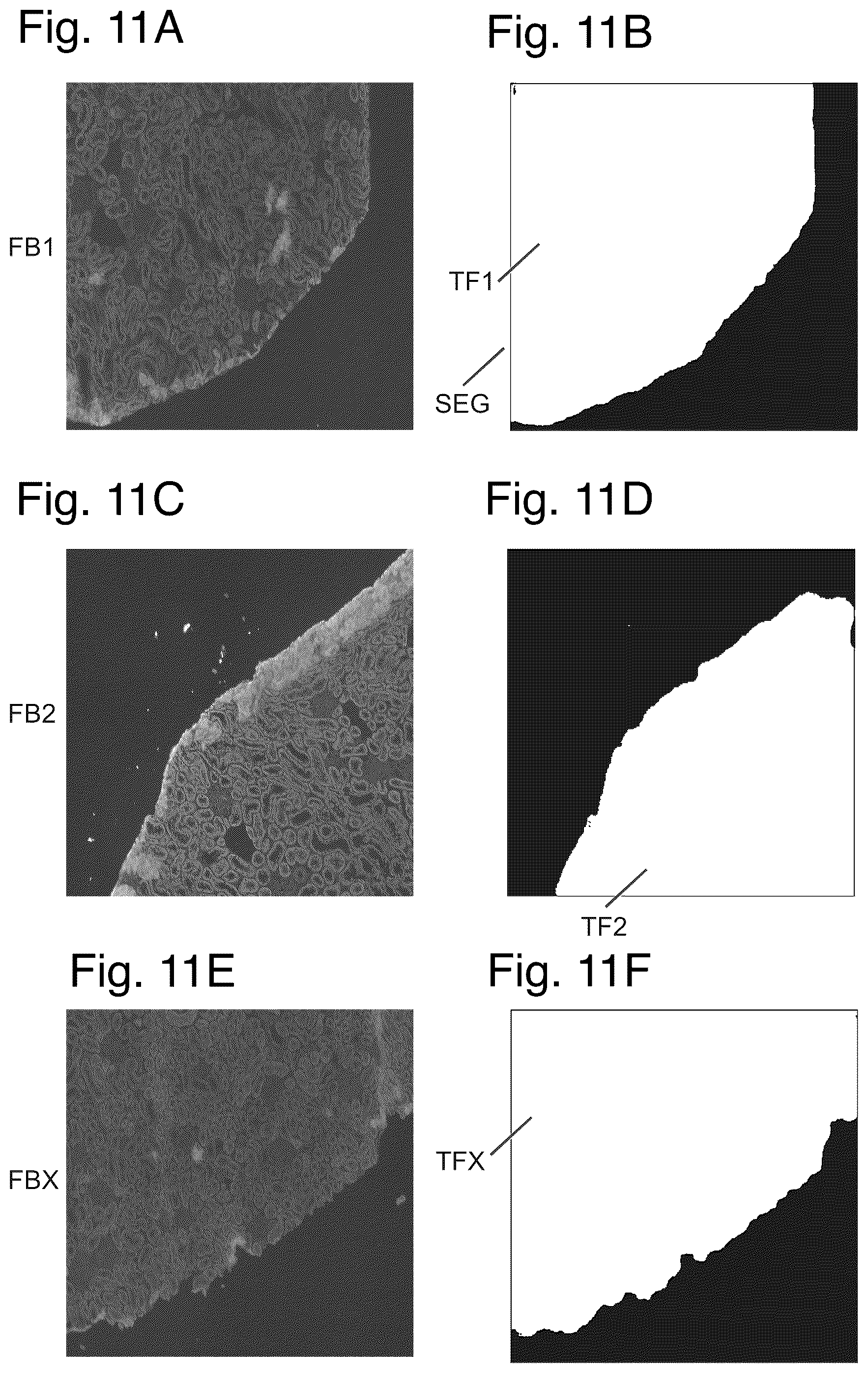 Patent US12480877 Figure 10 – Method and apparatus for detecting a presence of a fluorescence pattern type on an organ section by means of immunofluorescence microscopy