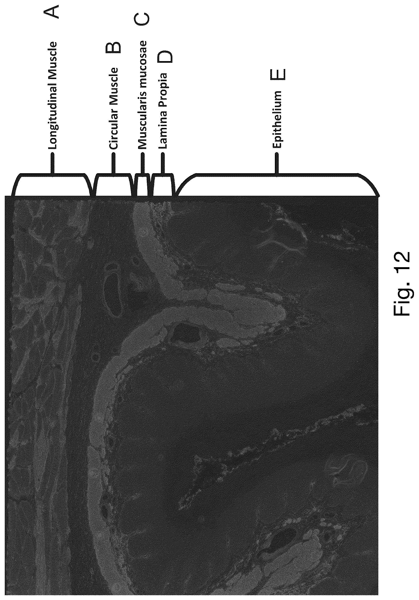 Patent US12480877 Figure 11 – Method and apparatus for detecting a presence of a fluorescence pattern type on an organ section by means of immunofluorescence microscopy