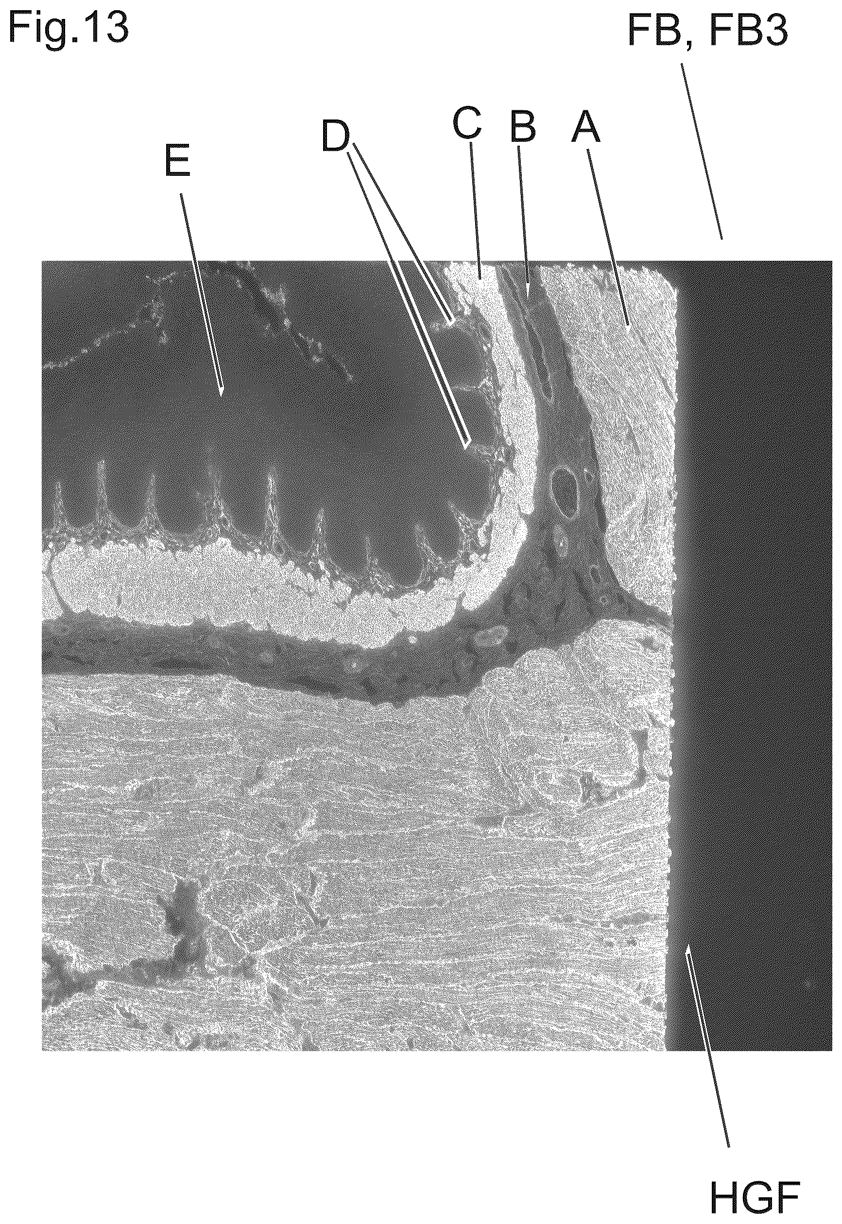Patent US12480877 Figure 12 – Method and apparatus for detecting a presence of a fluorescence pattern type on an organ section by means of immunofluorescence microscopy