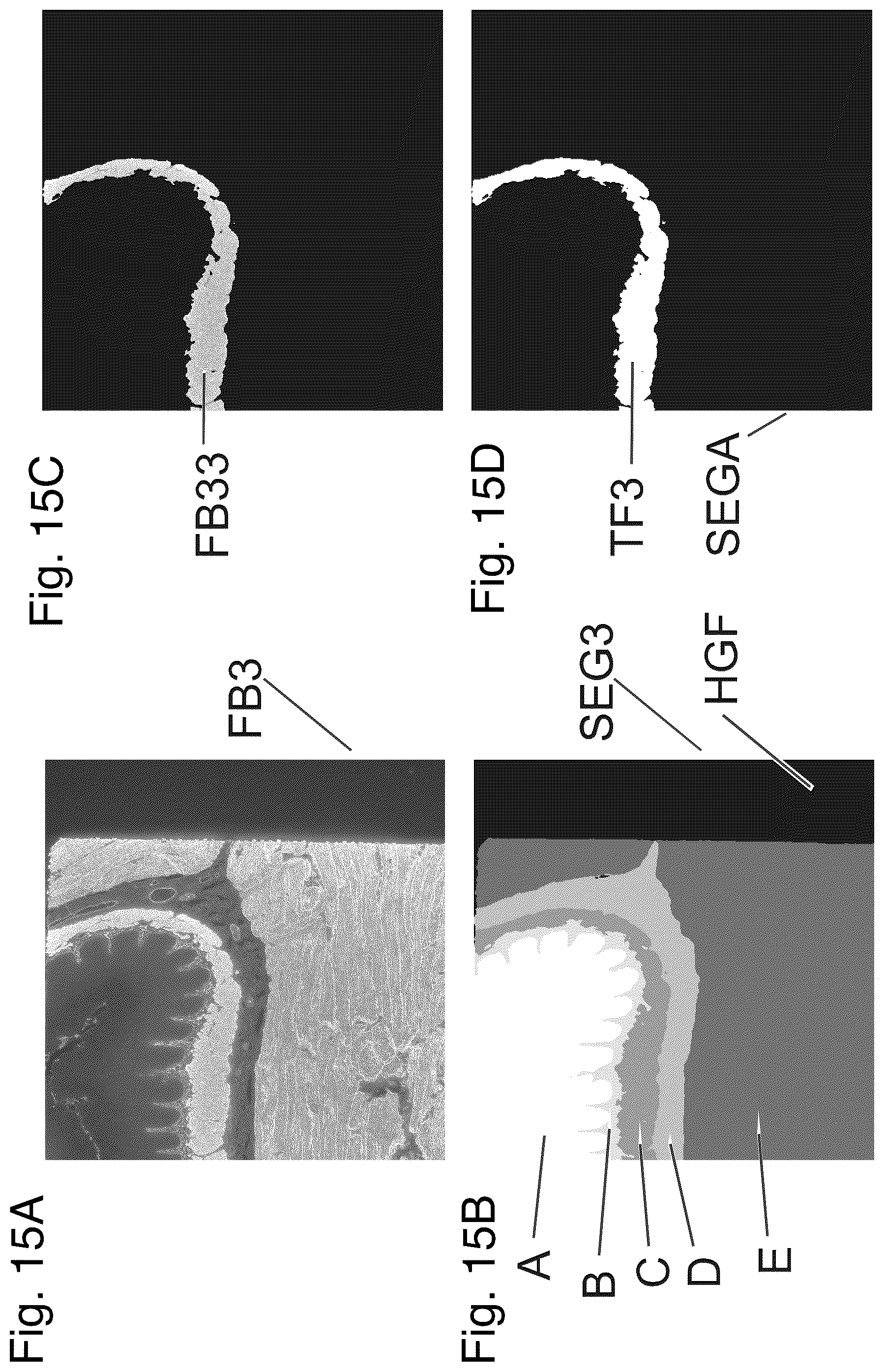 Patent US12480877 Figure 14 – Method and apparatus for detecting a presence of a fluorescence pattern type on an organ section by means of immunofluorescence microscopy