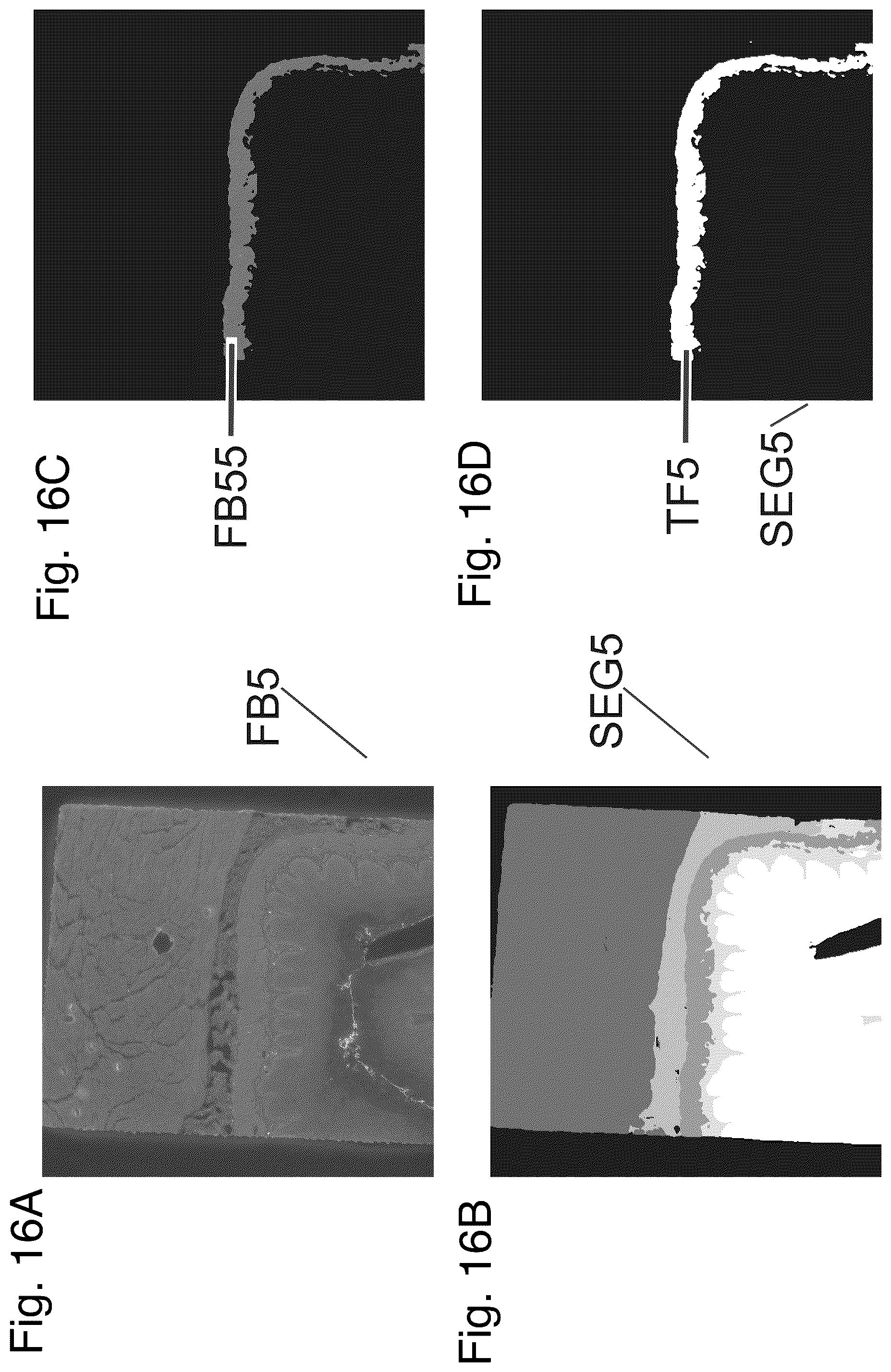Patent US12480877 Figure 15 – Method and apparatus for detecting a presence of a fluorescence pattern type on an organ section by means of immunofluorescence microscopy