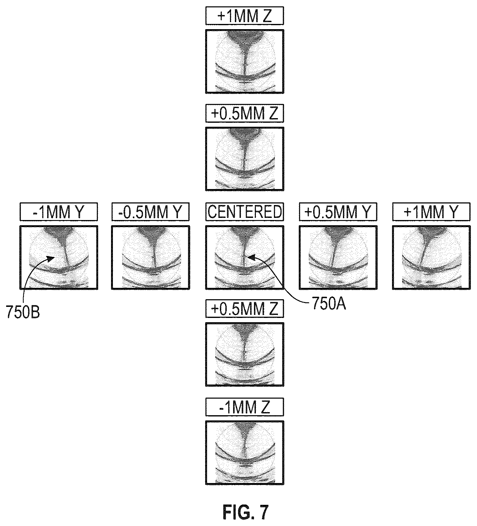 Patent US12480914 Figure 7 – Adaptive ultrasonic inspection for volumetric flaws