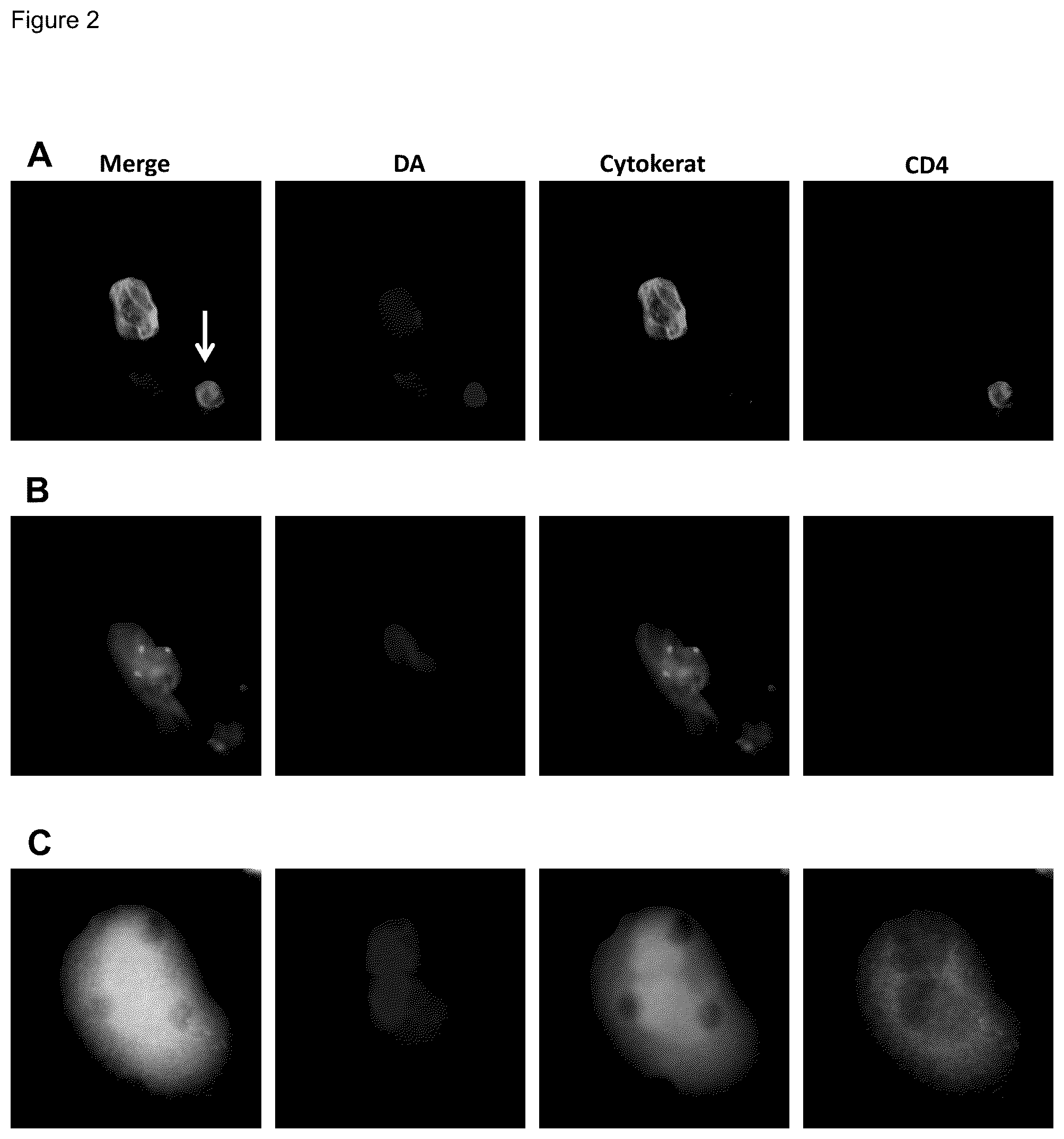 Patent US12480952 Figure 2 – Methods of using PD-L1 expression in treatment decisions for cancer therapy