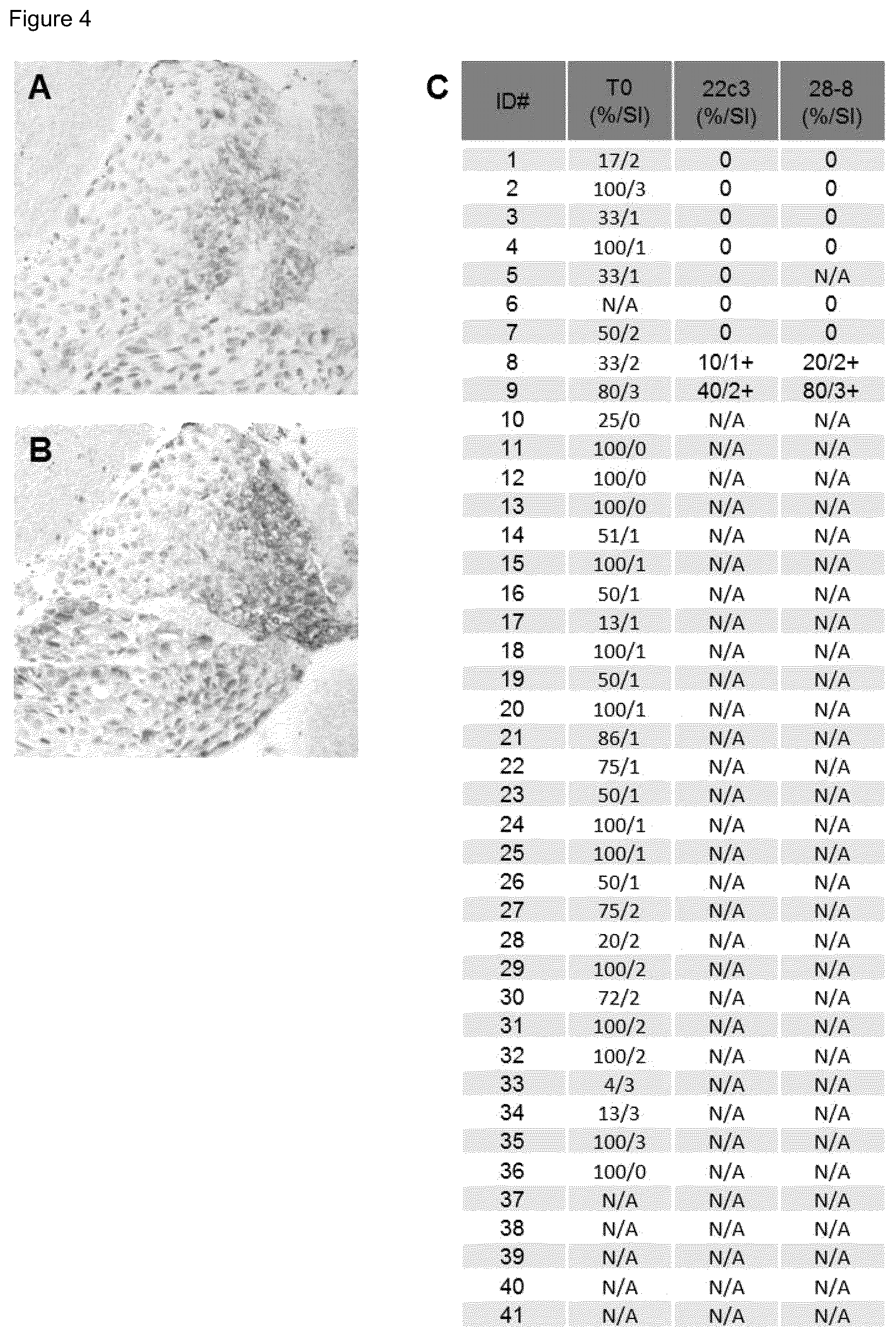 Patent US12480952 Figure 4 – Methods of using PD-L1 expression in treatment decisions for cancer therapy