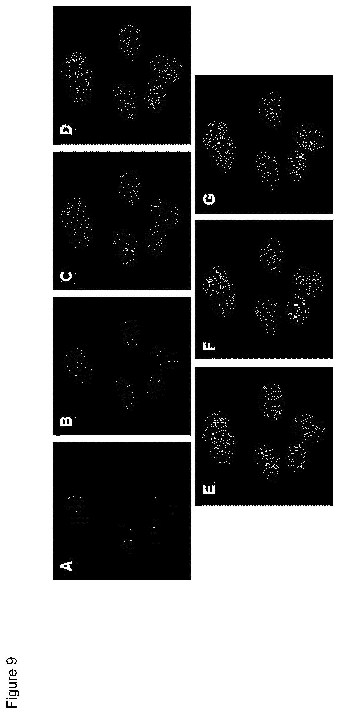Patent US12480952 Figure 9 – Methods of using PD-L1 expression in treatment decisions for cancer therapy