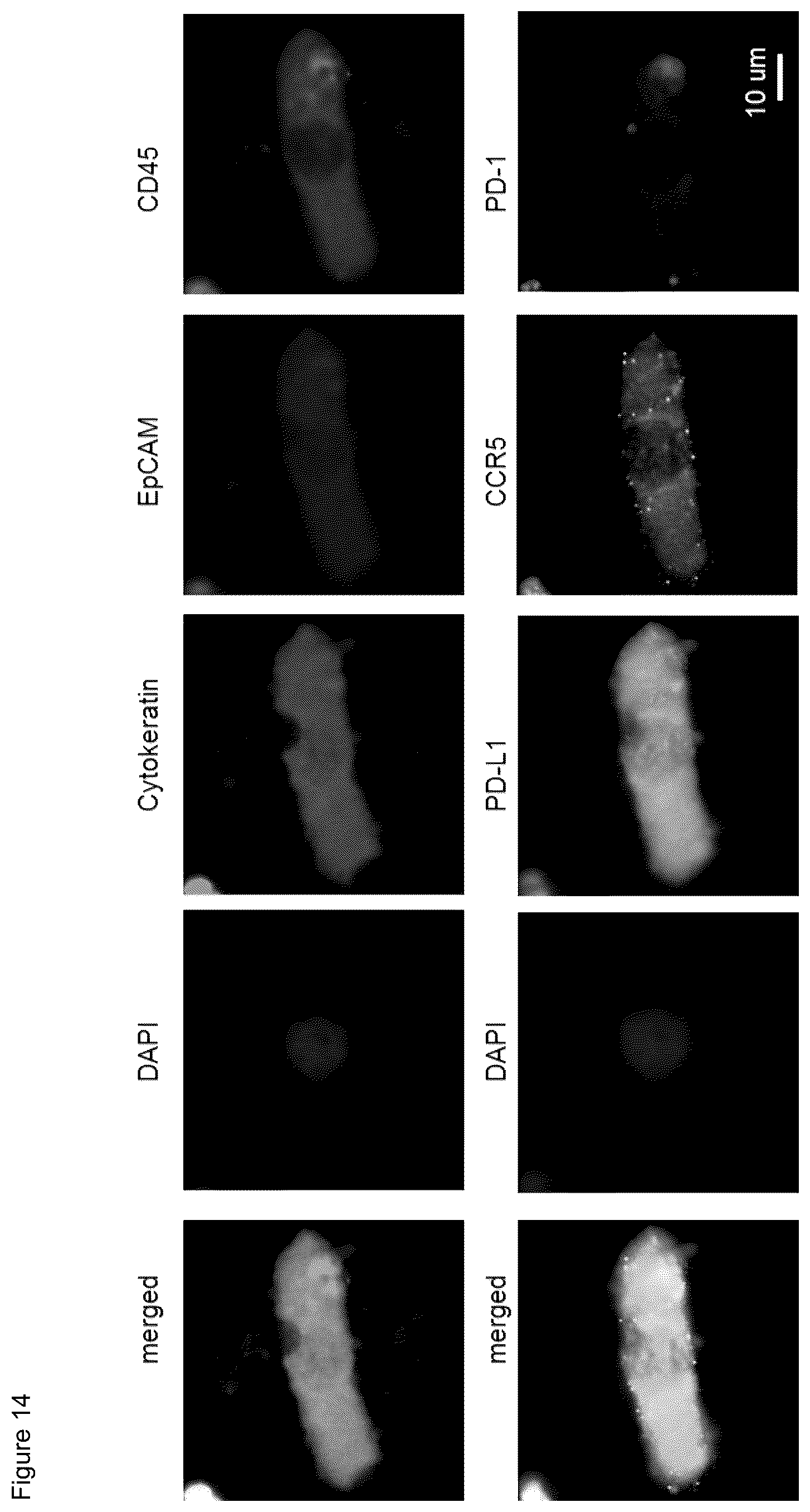Patent US12480952 Figure 13 – Methods of using PD-L1 expression in treatment decisions for cancer therapy