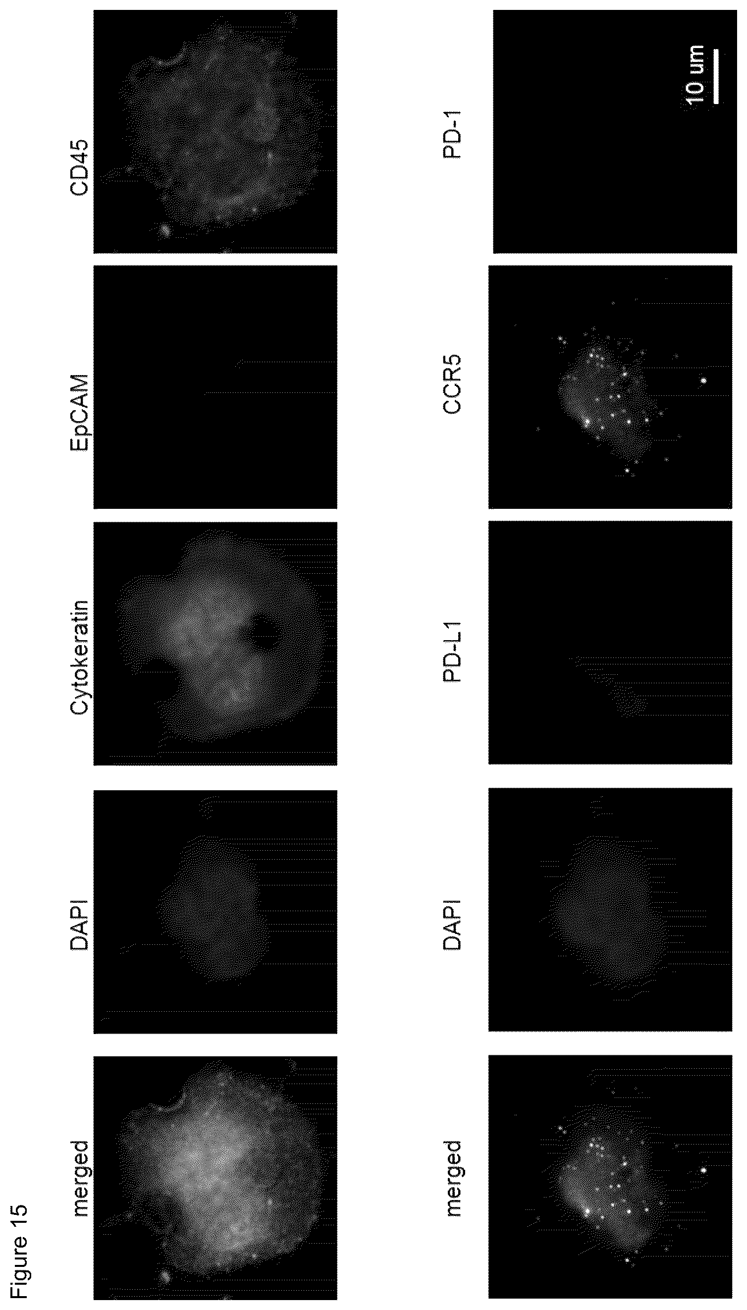 Patent US12480952 Figure 14 – Methods of using PD-L1 expression in treatment decisions for cancer therapy