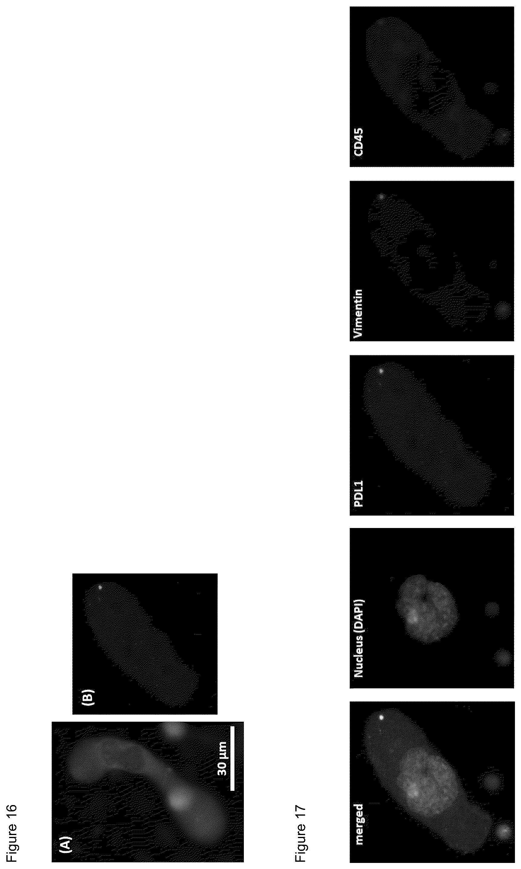 Patent US12480952 Figure 15 – Methods of using PD-L1 expression in treatment decisions for cancer therapy
