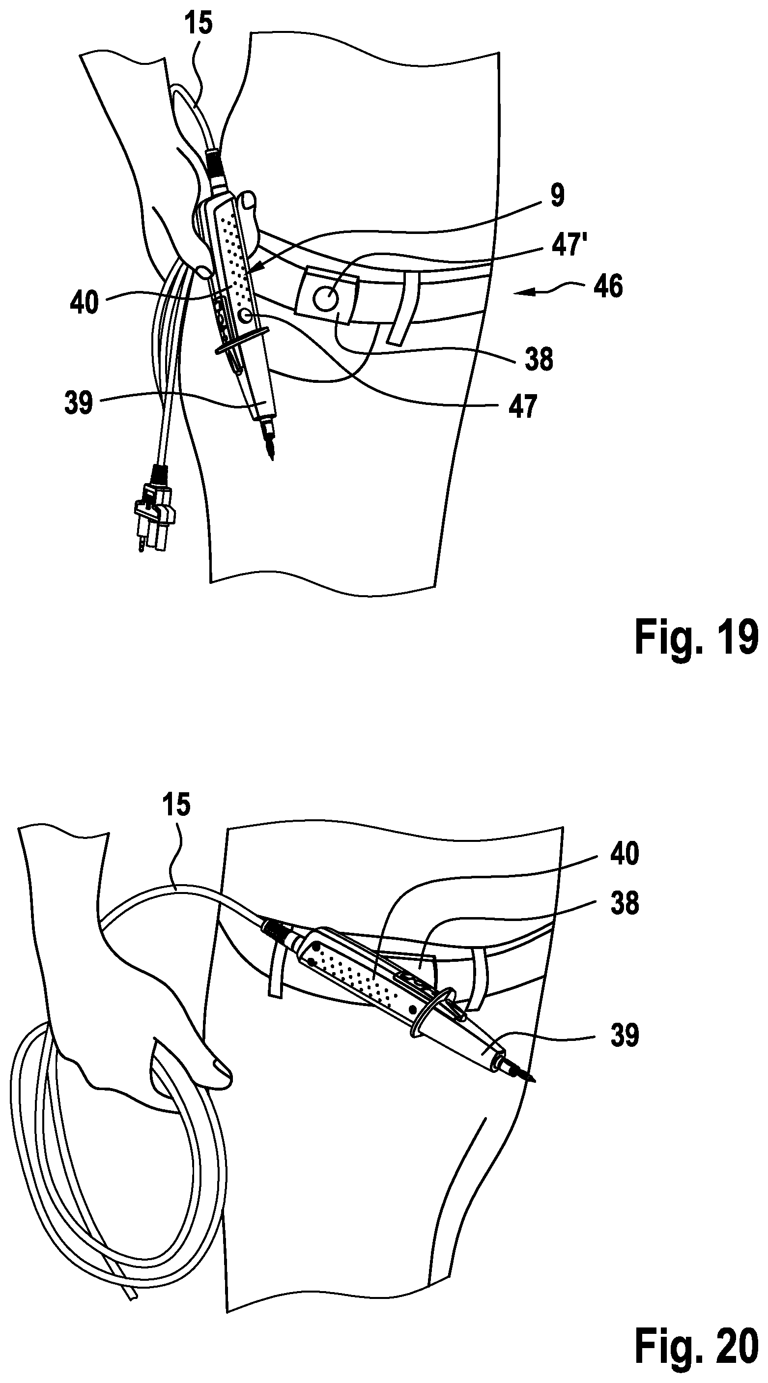 Patent US12480971 Figure 12 – Measuring instrument assembly comprising a measuring instrument apparatus for measuring electrical measurement variables