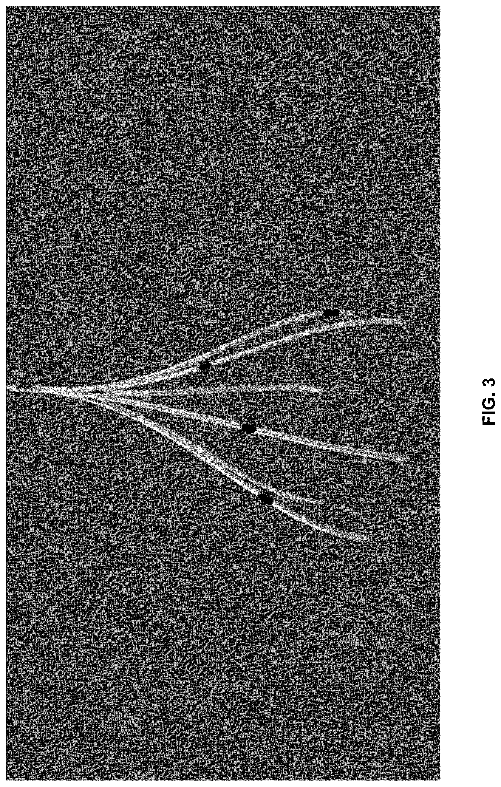 Patent US12488288 Figure 3 – Presurgical planning