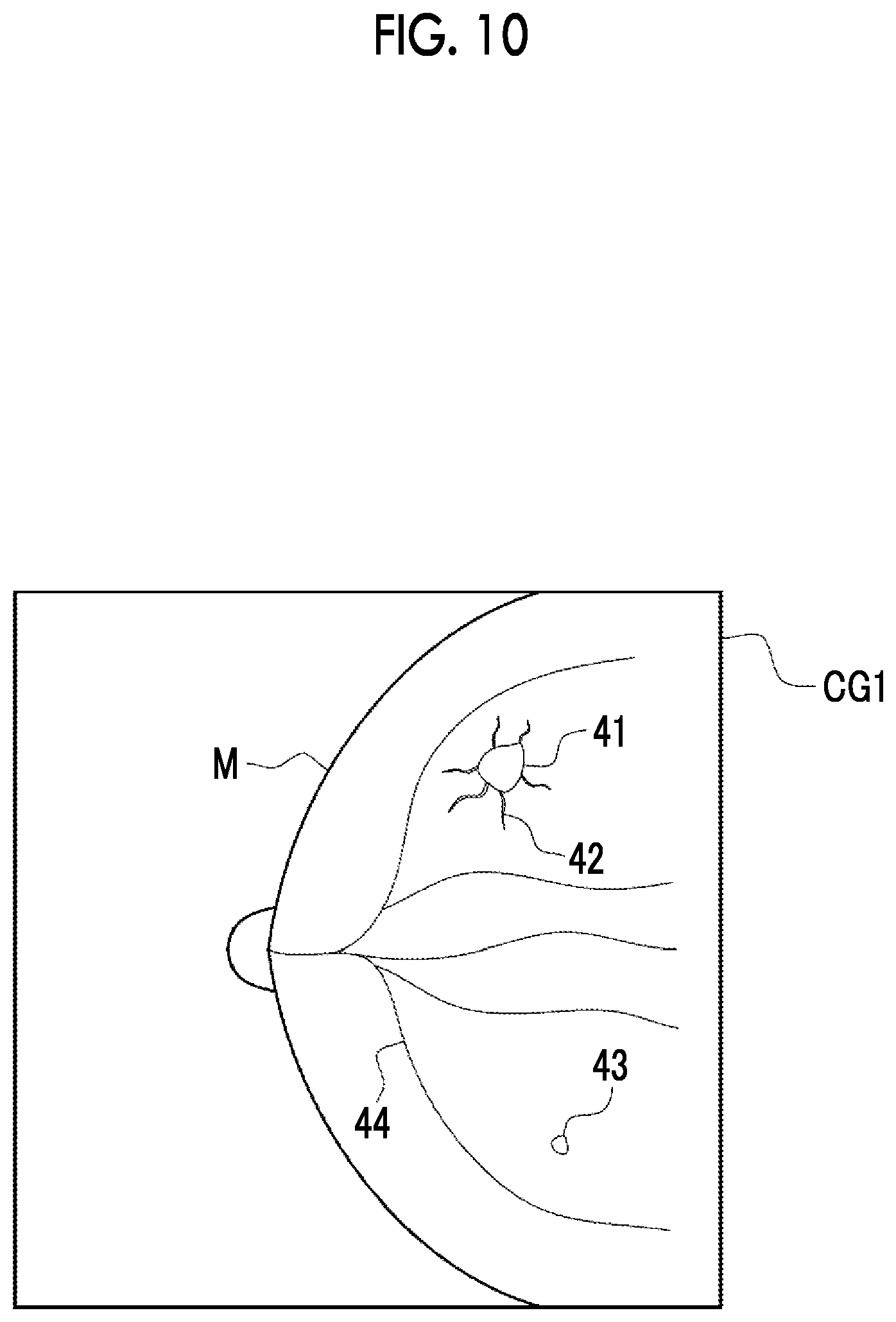 Patent US12488423 Figure 8 – Image processing device, method for operating image processing device, and program for operating image processing device