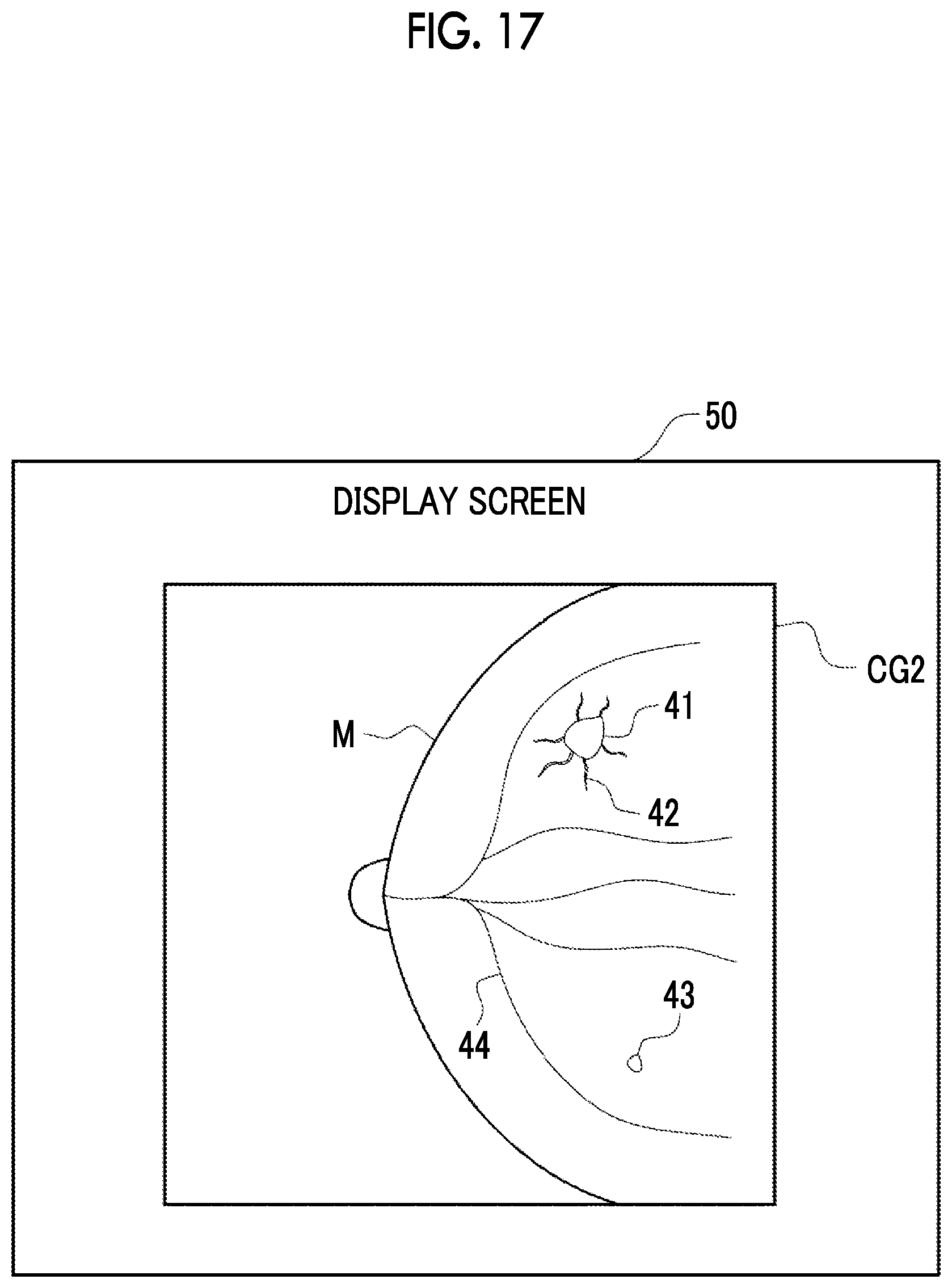 Patent US12488423 Figure 15 – Image processing device, method for operating image processing device, and program for operating image processing device