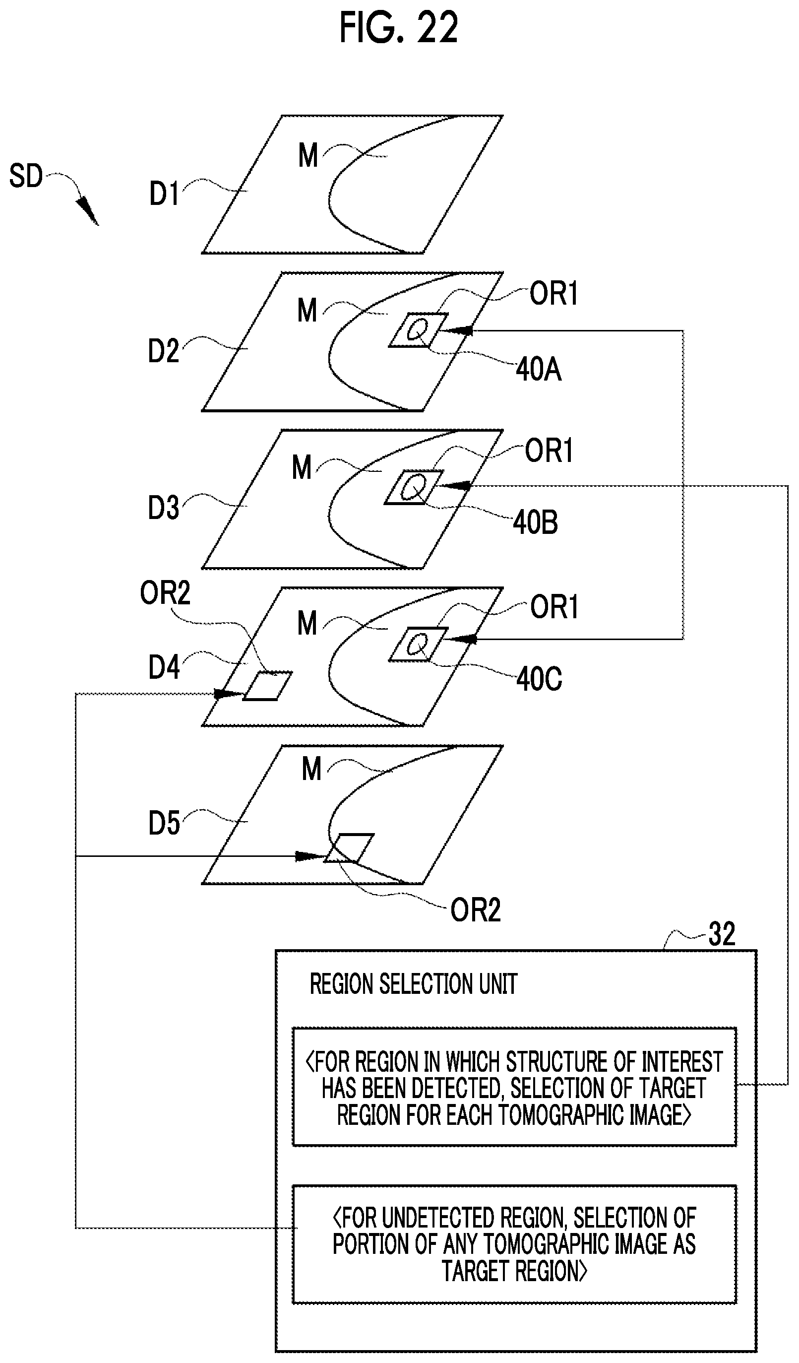 Patent US12488423 Figure 19 – Image processing device, method for operating image processing device, and program for operating image processing device