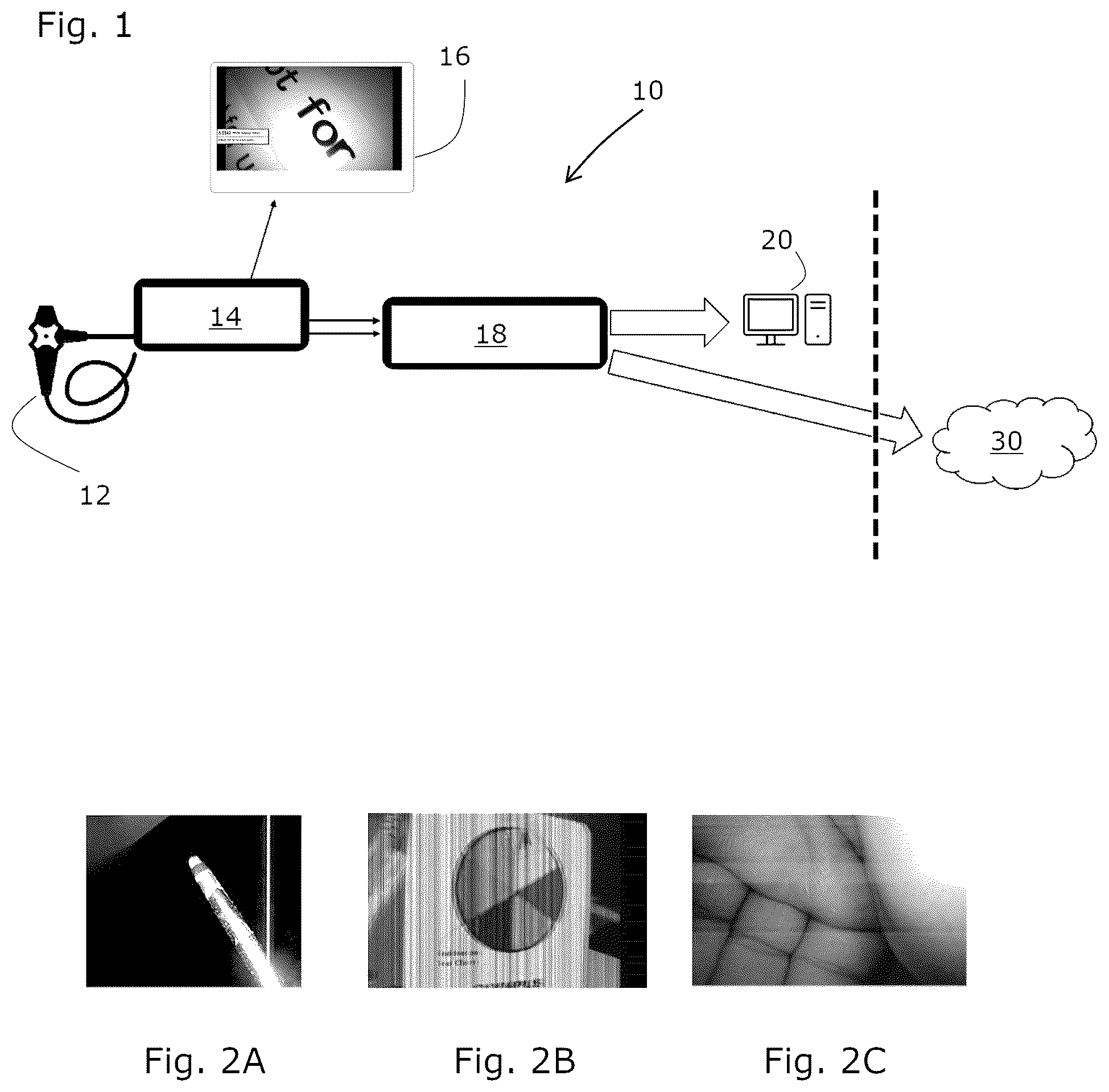 Patent US12488444 Figure 1 – Method, software program and system for detecting image irregularities in video endoscopic instrument produced images