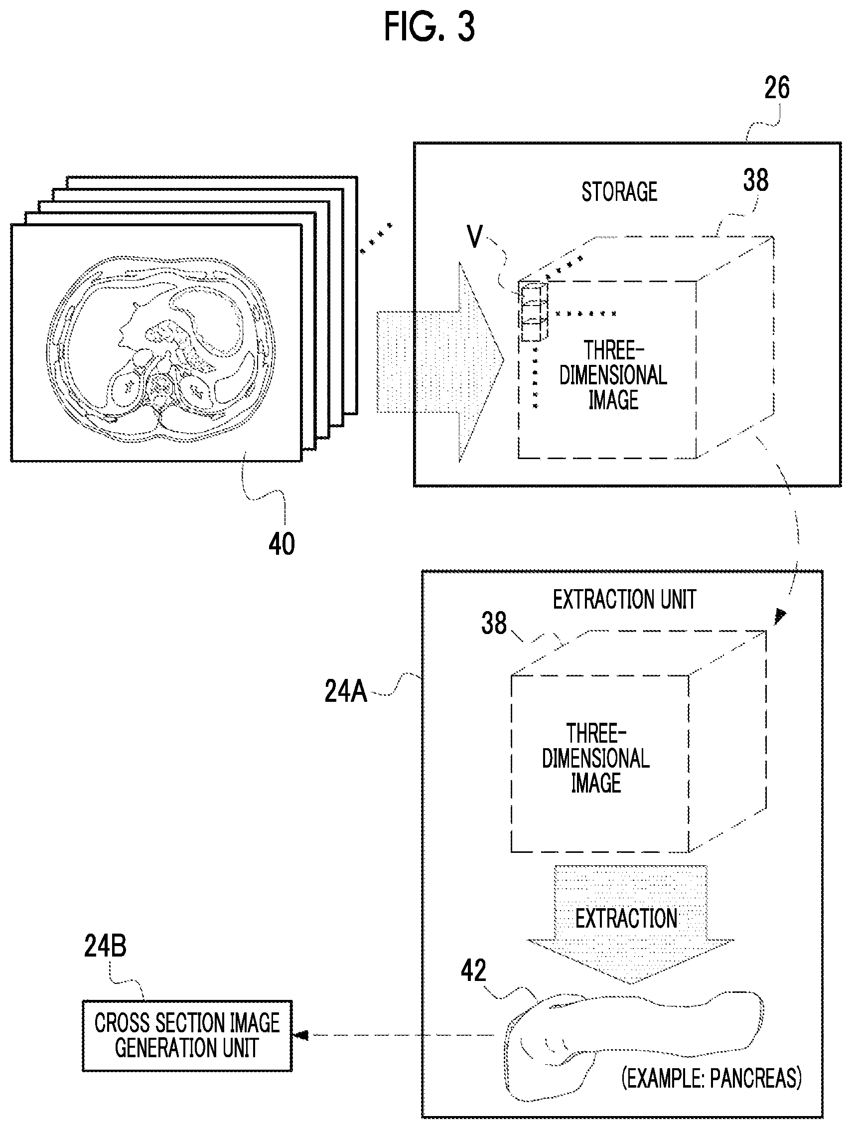 Patent US12488458 Figure 3 – Image processing device, image processing method, and program for outputting information for displaying two-dimensional image corresponding to cross section