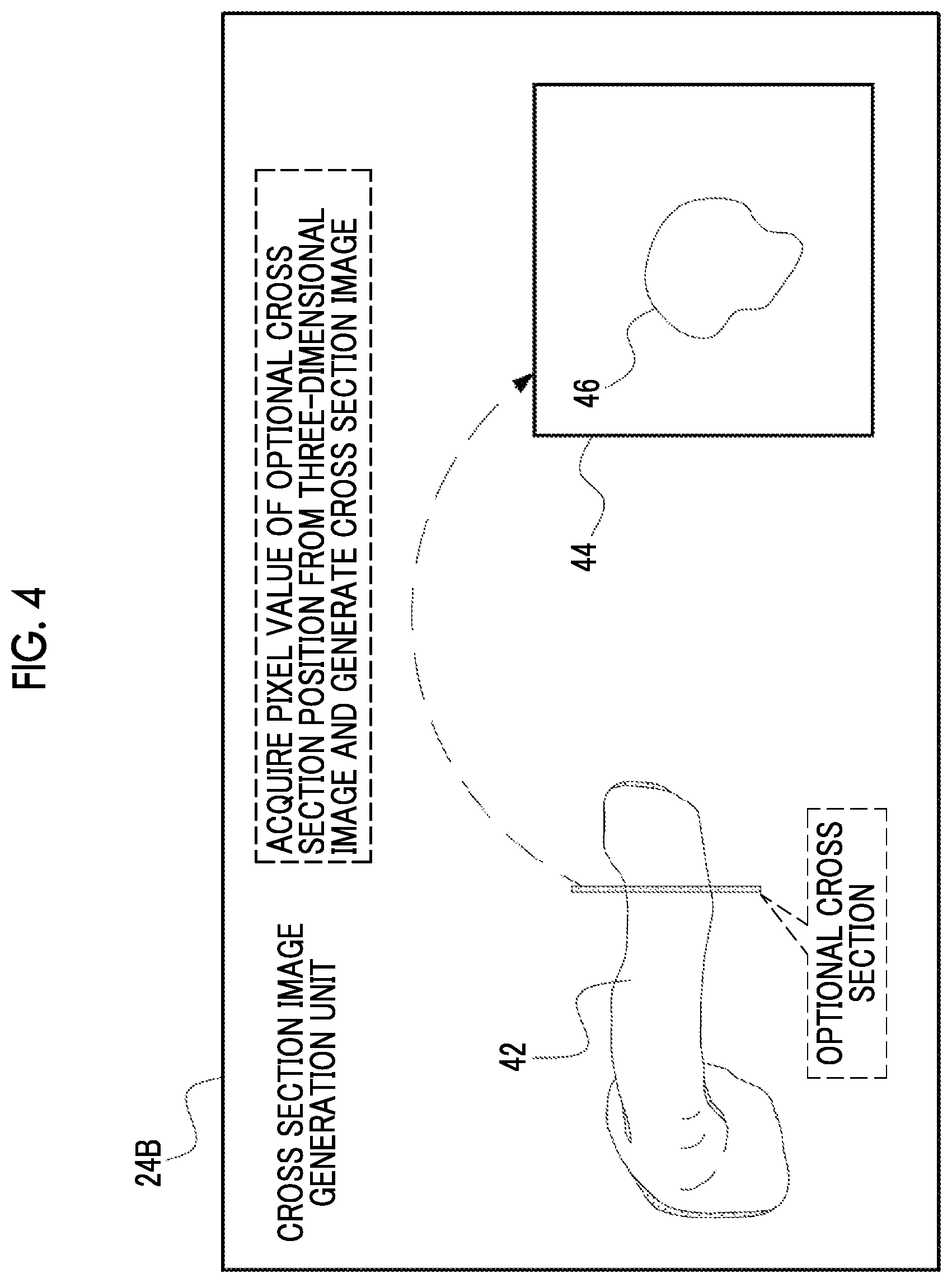 Patent US12488458 Figure 4 – Image processing device, image processing method, and program for outputting information for displaying two-dimensional image corresponding to cross section