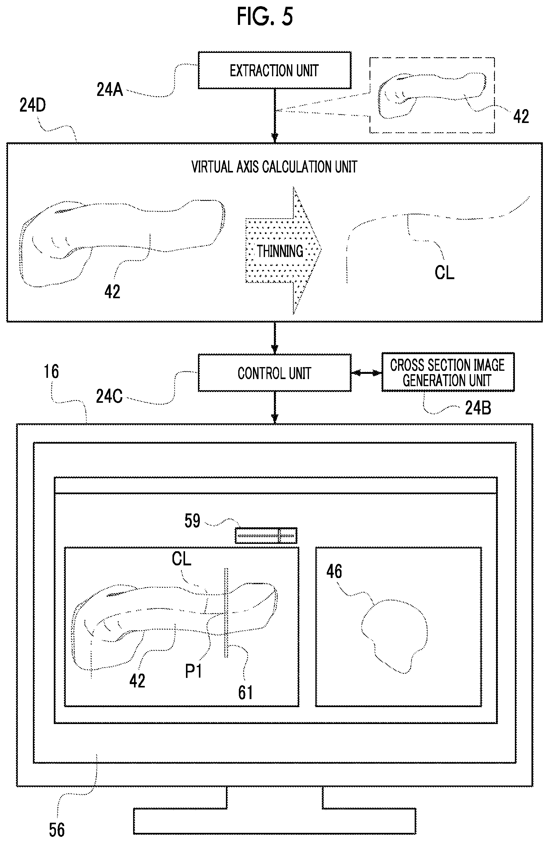 Patent US12488458 Figure 5 – Image processing device, image processing method, and program for outputting information for displaying two-dimensional image corresponding to cross section