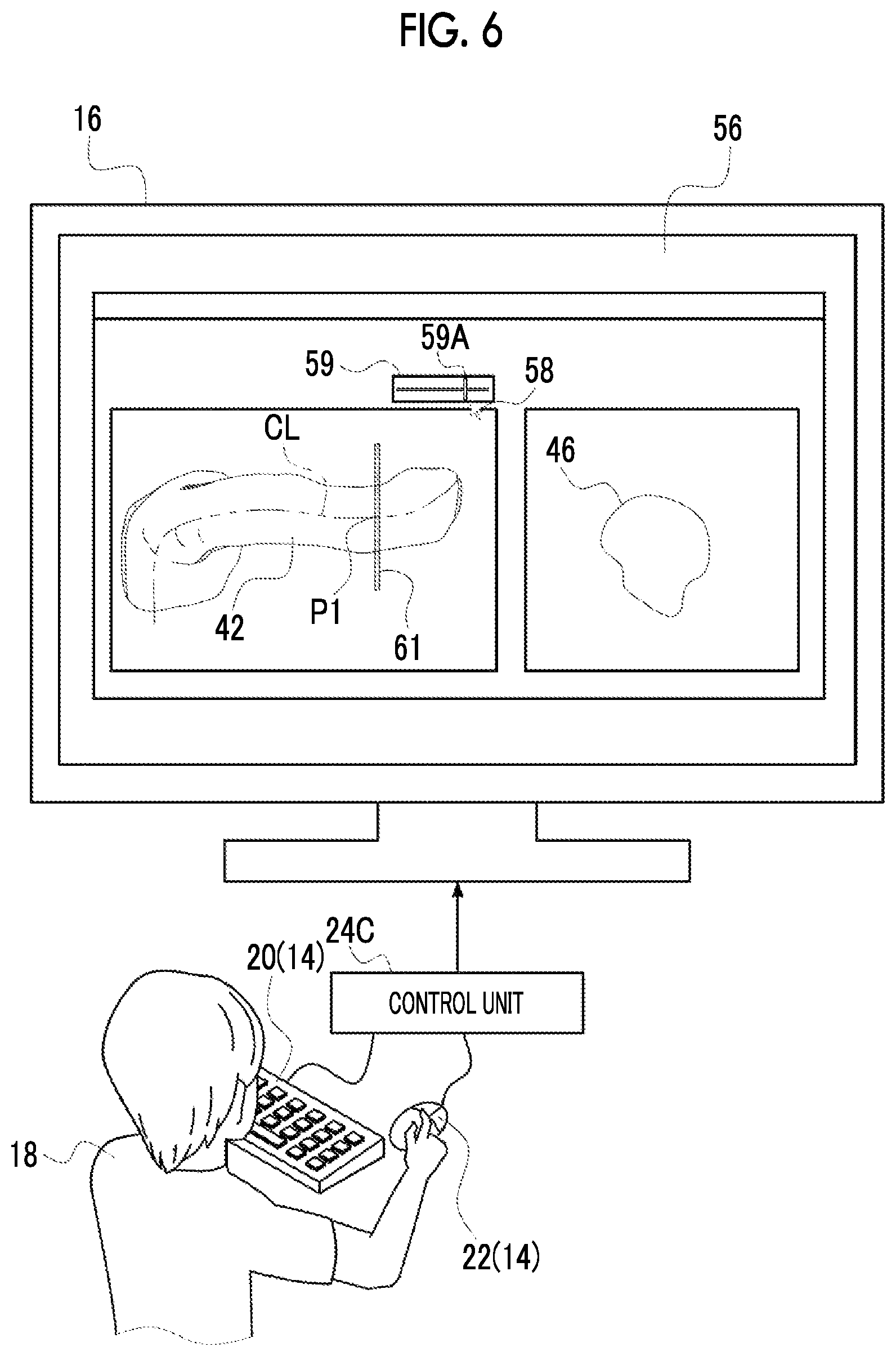 Patent US12488458 Figure 6 – Image processing device, image processing method, and program for outputting information for displaying two-dimensional image corresponding to cross section