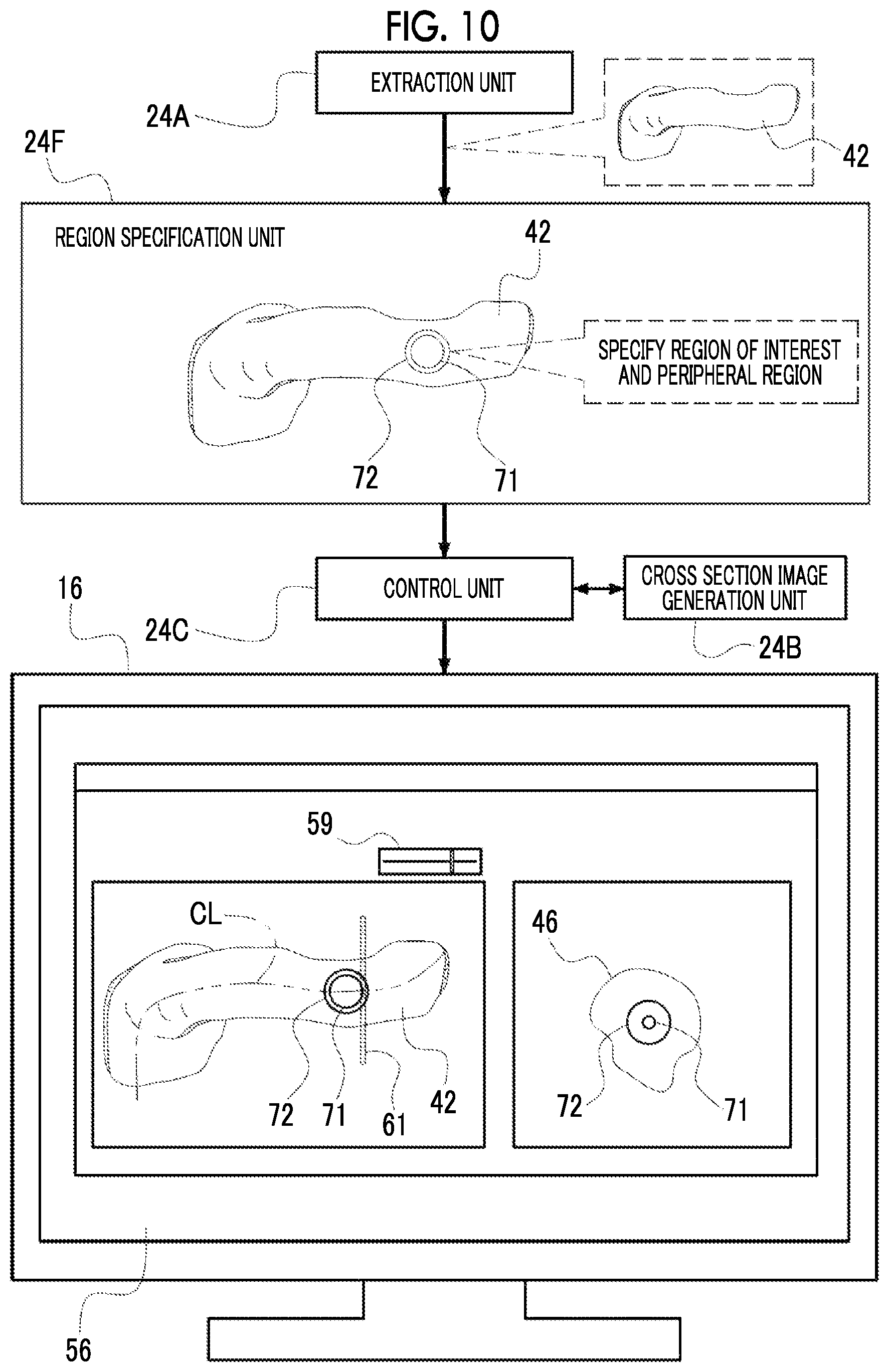 Patent US12488458 Figure 10 – Image processing device, image processing method, and program for outputting information for displaying two-dimensional image corresponding to cross section