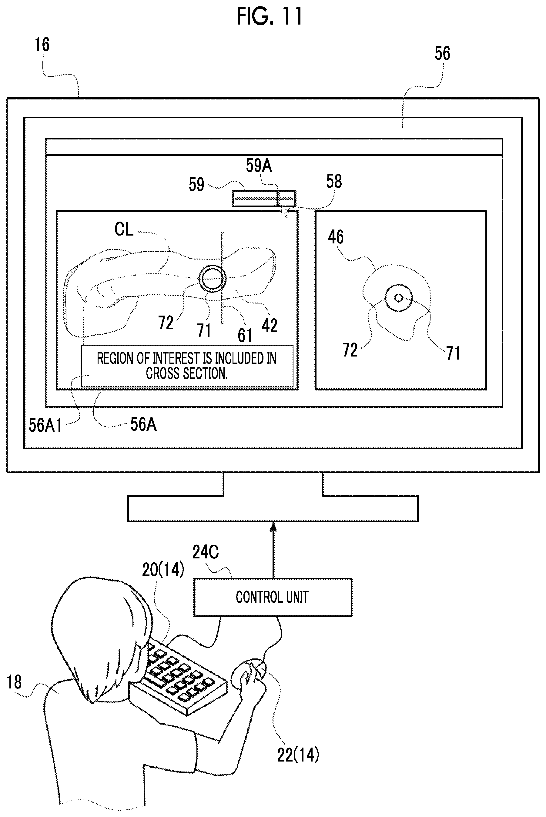 Patent US12488458 Figure 11 – Image processing device, image processing method, and program for outputting information for displaying two-dimensional image corresponding to cross section