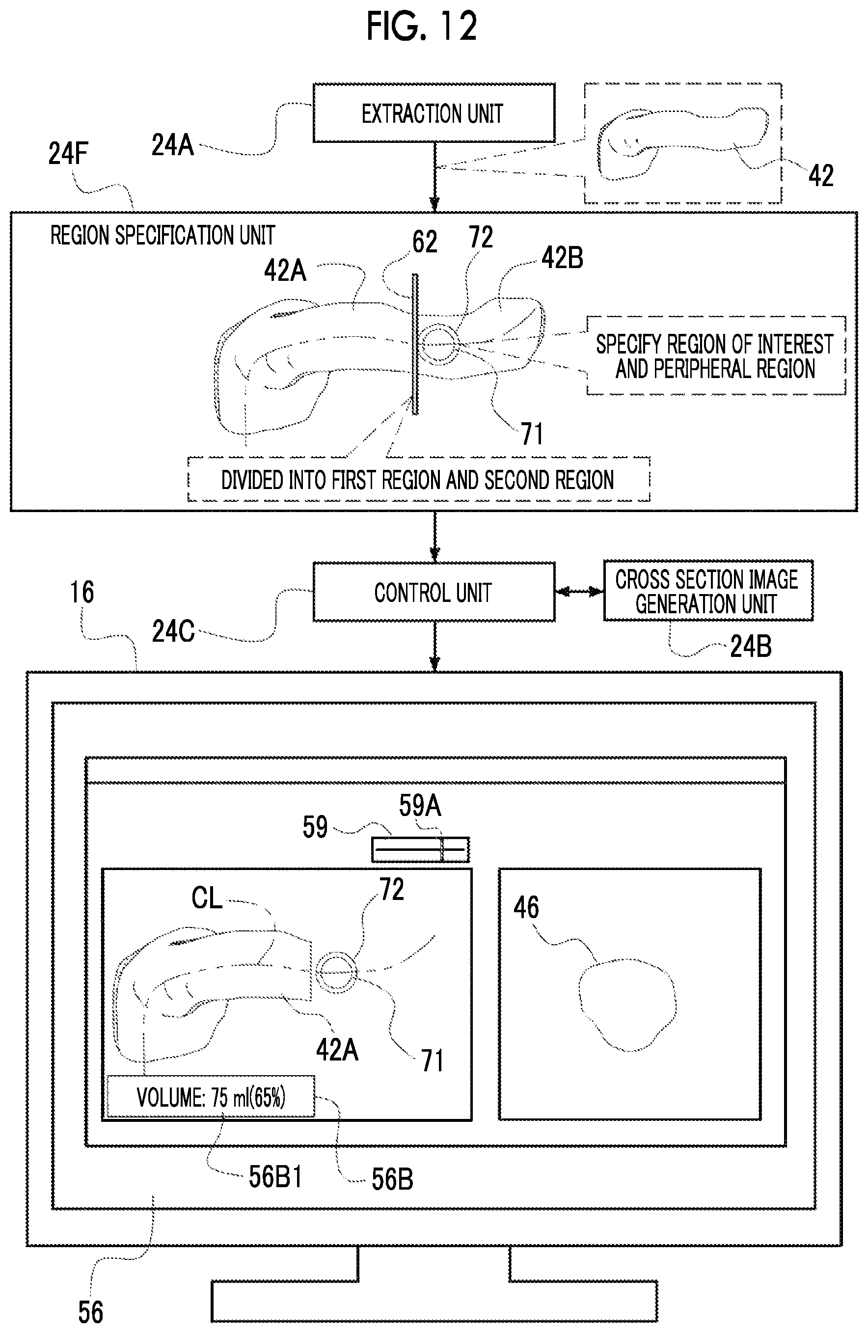 Patent US12488458 Figure 12 – Image processing device, image processing method, and program for outputting information for displaying two-dimensional image corresponding to cross section