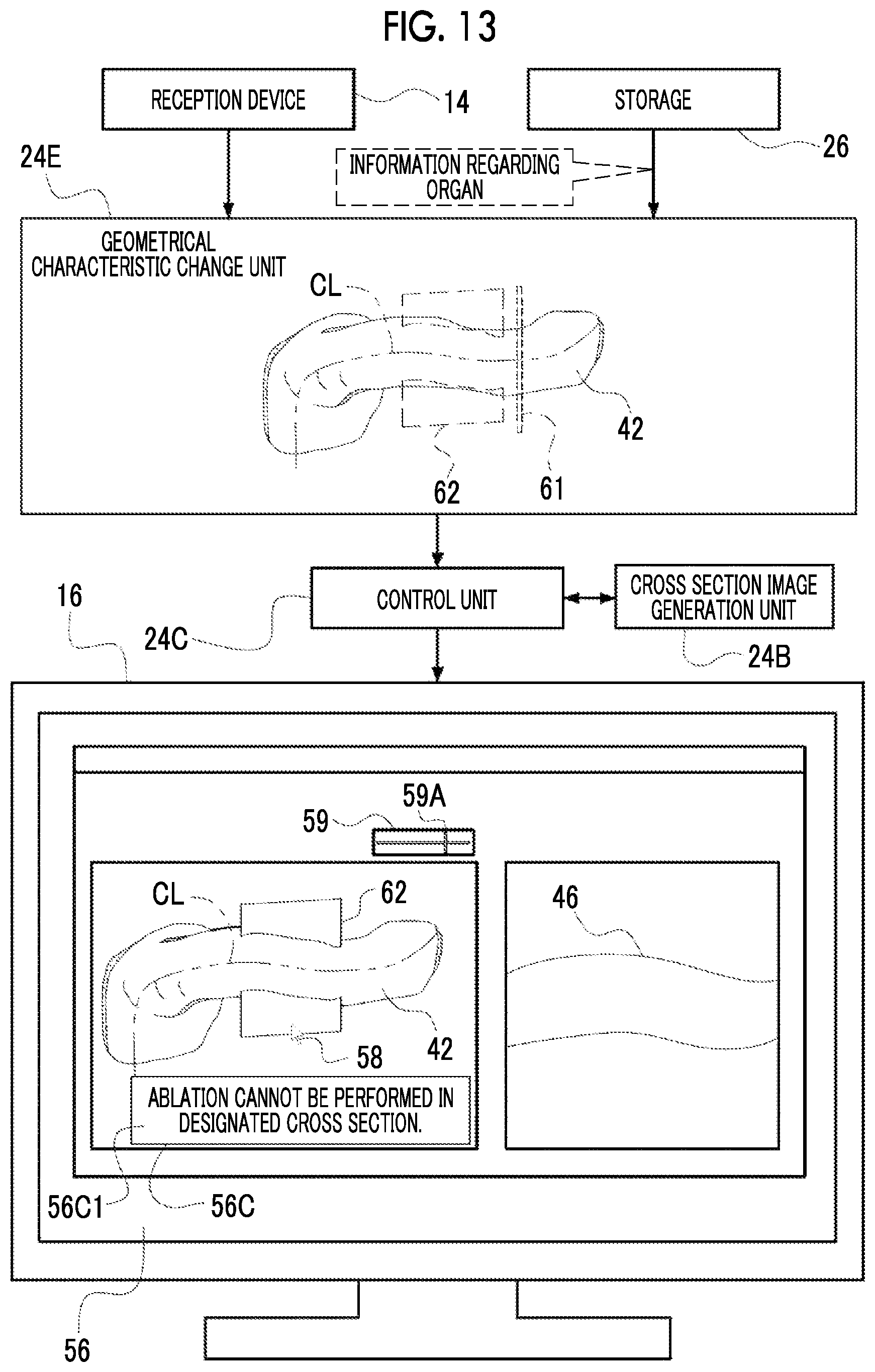 Patent US12488458 Figure 13 – Image processing device, image processing method, and program for outputting information for displaying two-dimensional image corresponding to cross section