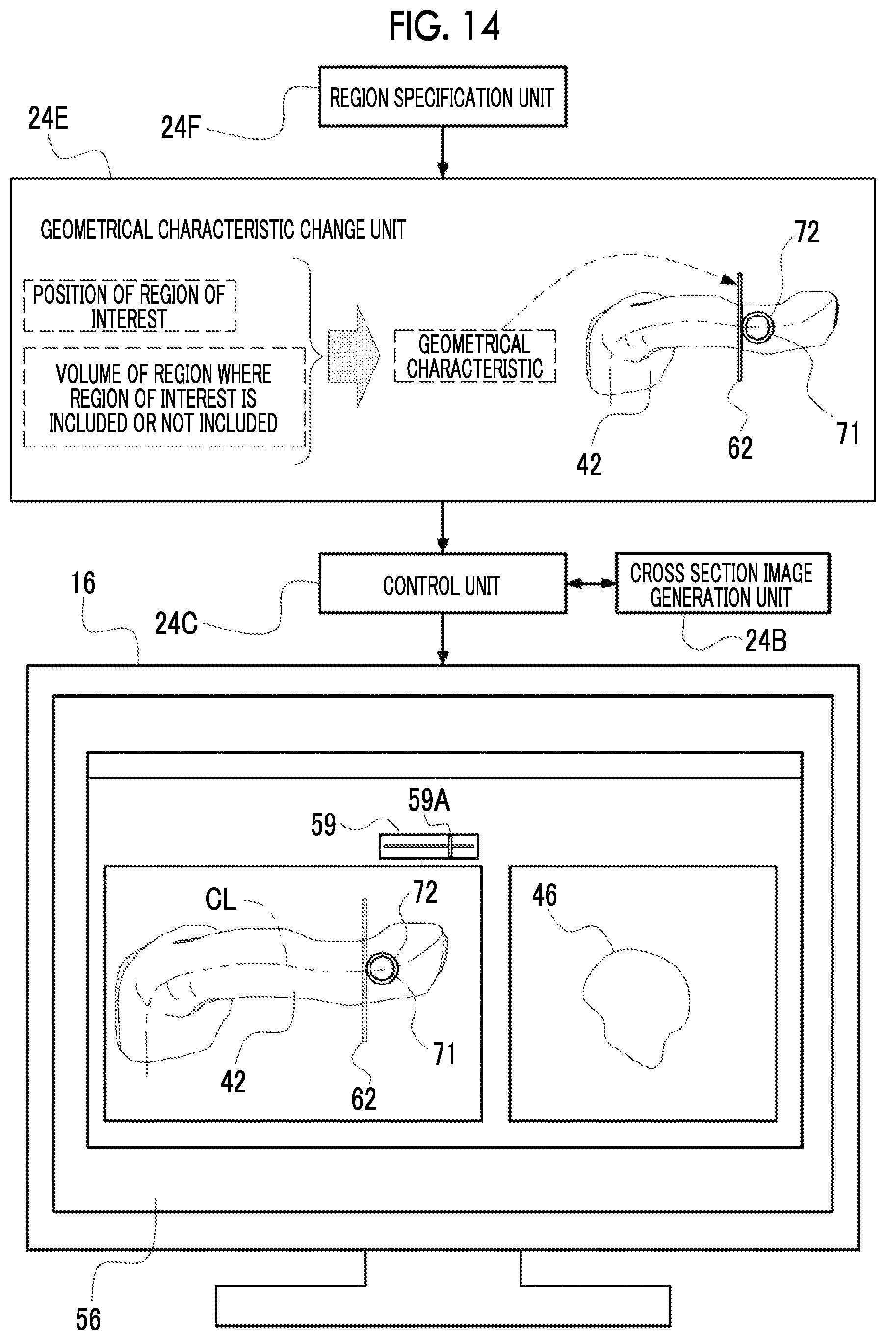 Patent US12488458 Figure 14 – Image processing device, image processing method, and program for outputting information for displaying two-dimensional image corresponding to cross section