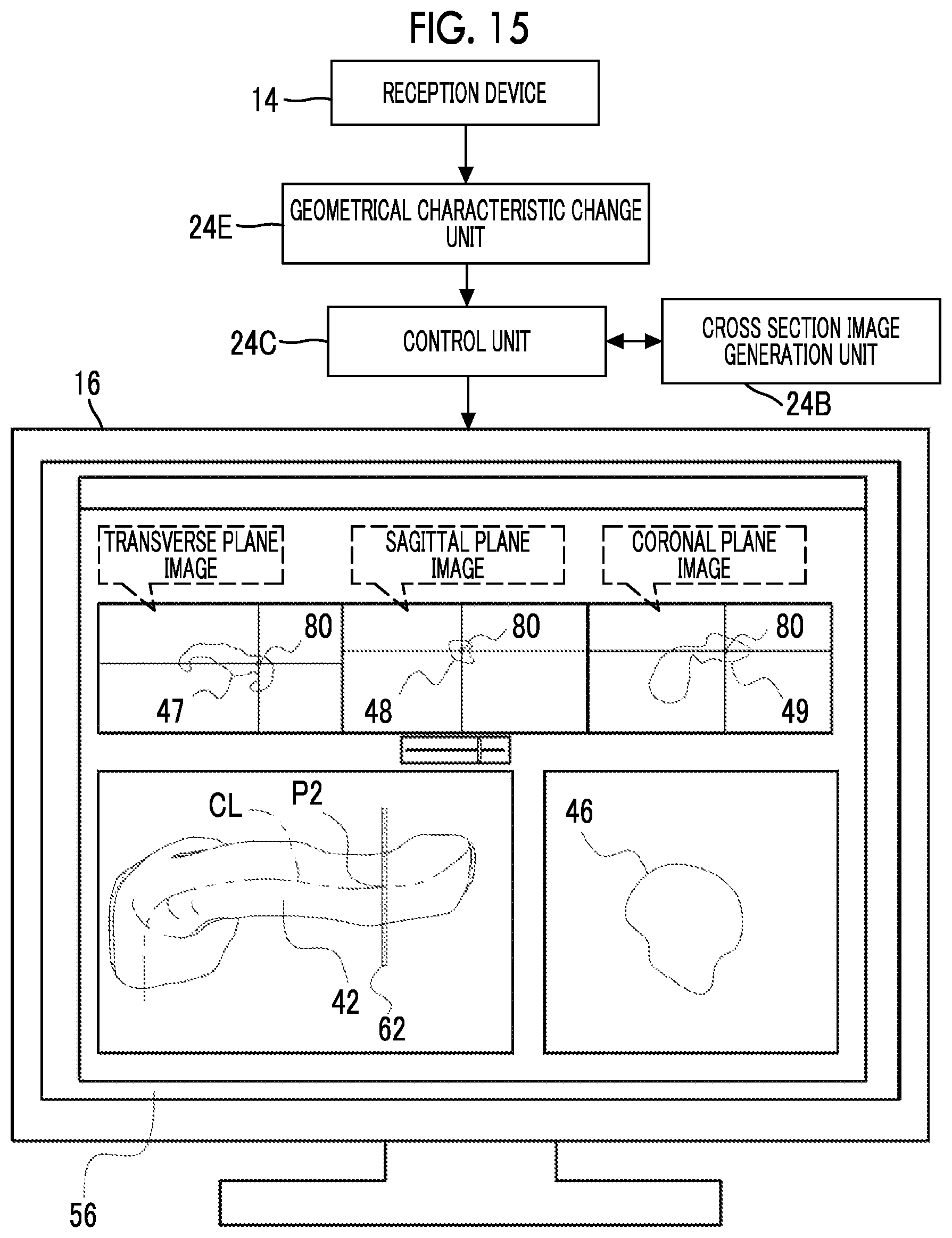 Patent US12488458 Figure 15 – Image processing device, image processing method, and program for outputting information for displaying two-dimensional image corresponding to cross section