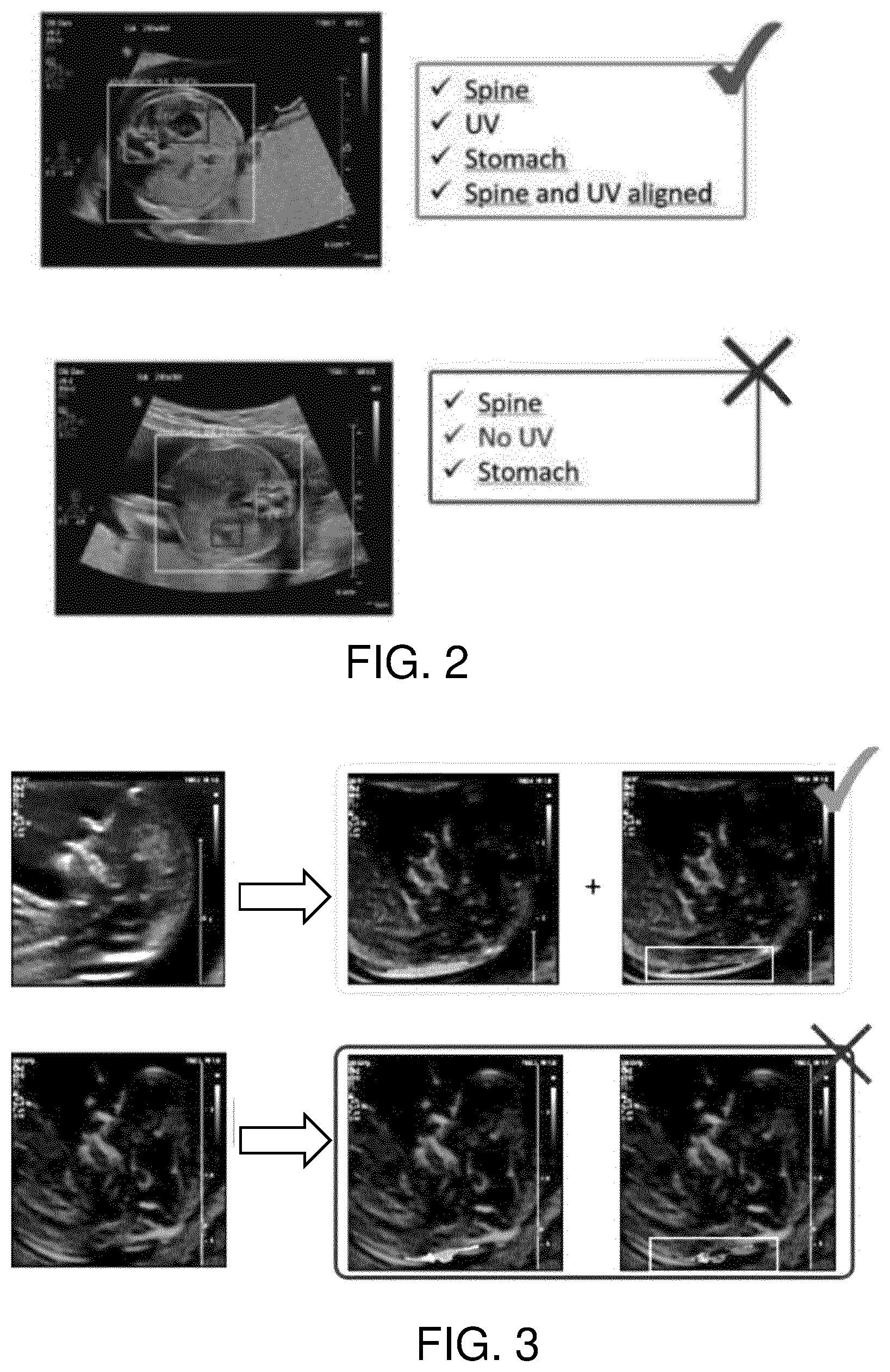 Patent US12488467 Figure 2 – Multiple-quality assessments from single segmentation algorithm