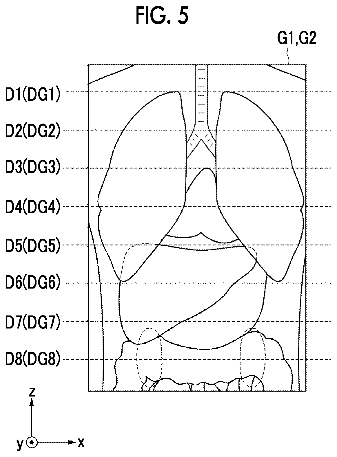 Patent US12488479 Figure 4 – Image alignment apparatus, method, and program