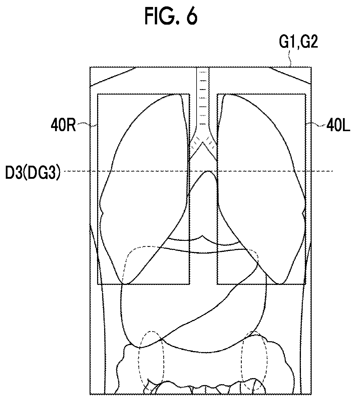 Patent US12488479 Figure 5 – Image alignment apparatus, method, and program
