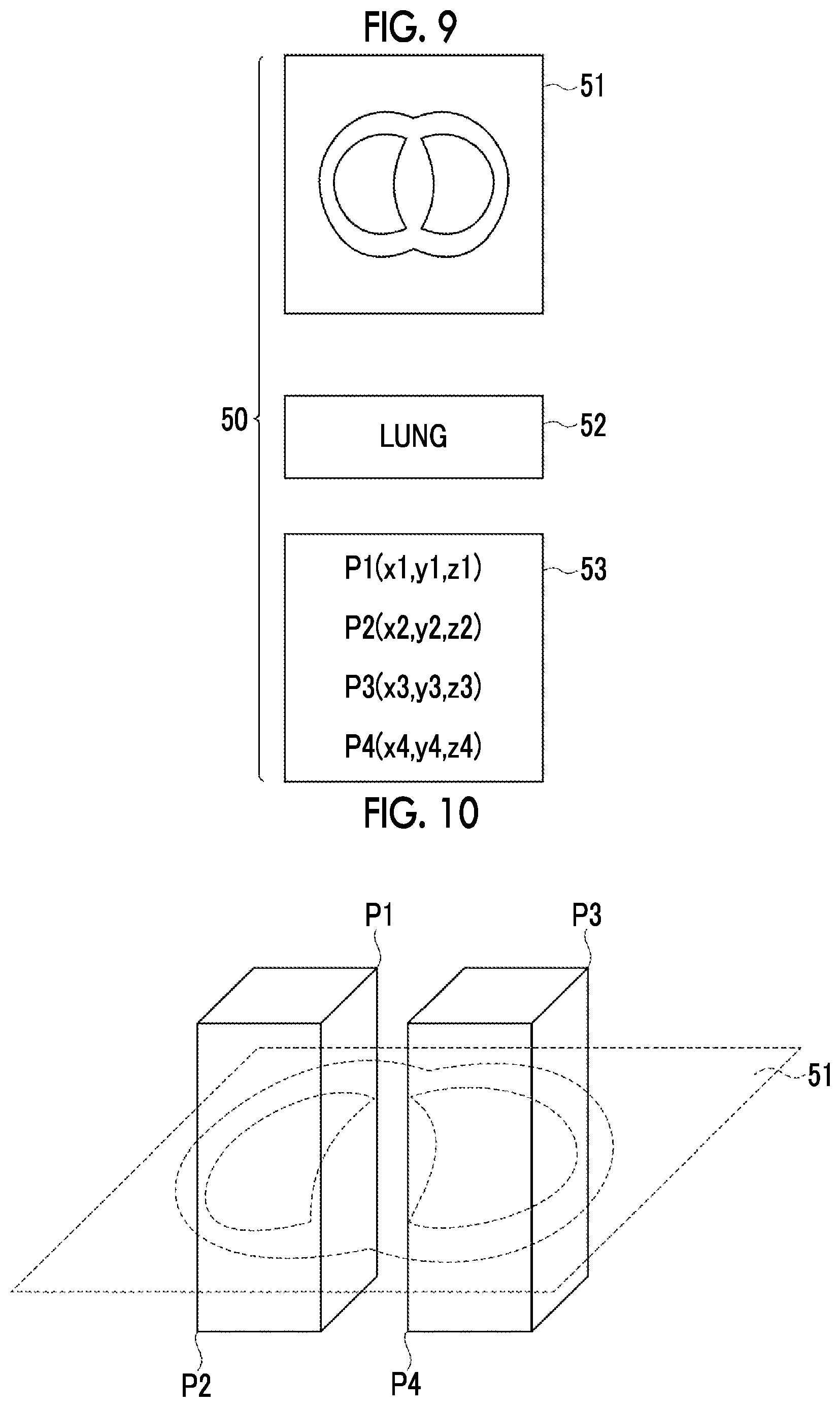 Patent US12488479 Figure 7 – Image alignment apparatus, method, and program