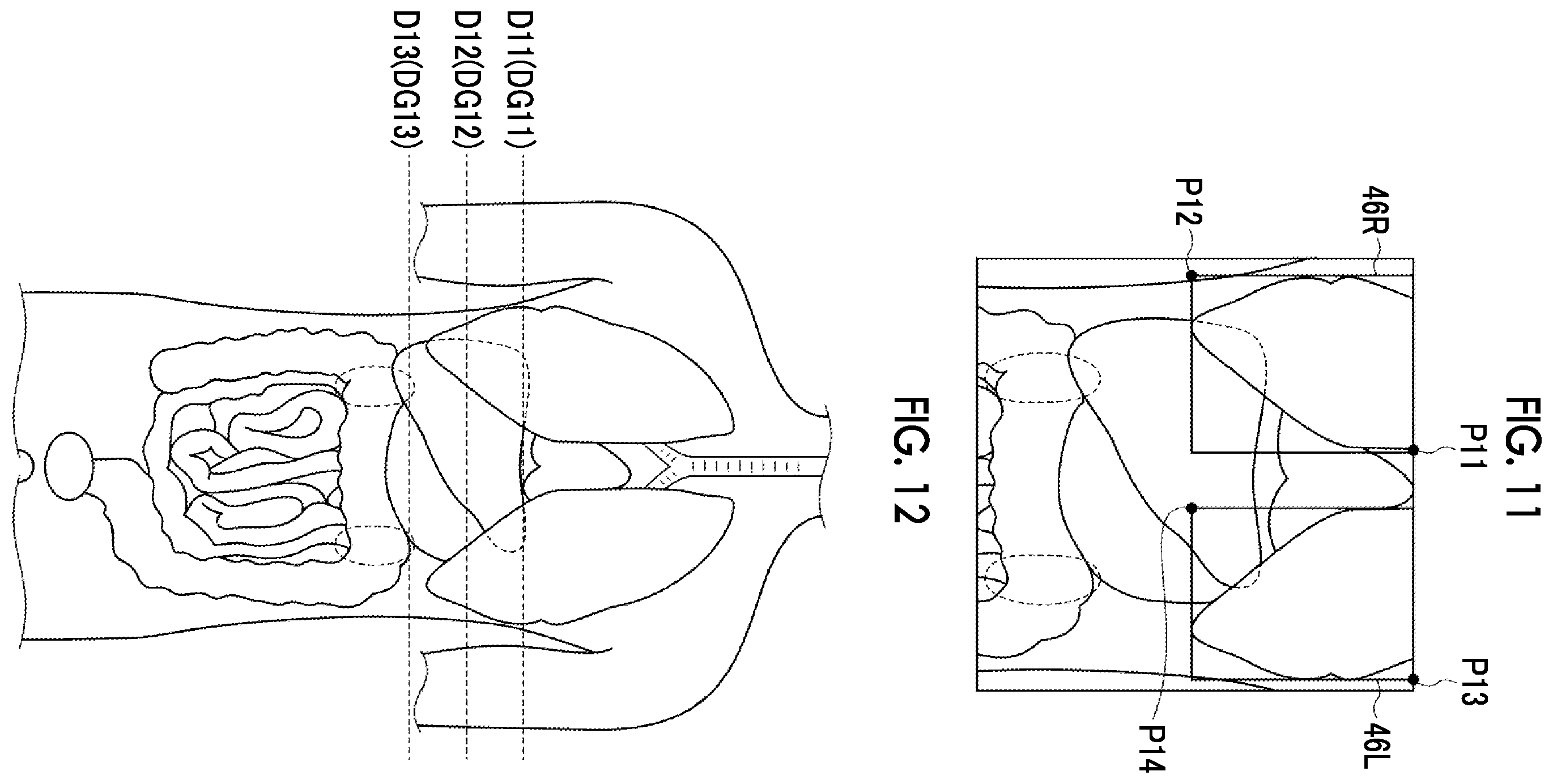 Patent US12488479 Figure 8 – Image alignment apparatus, method, and program