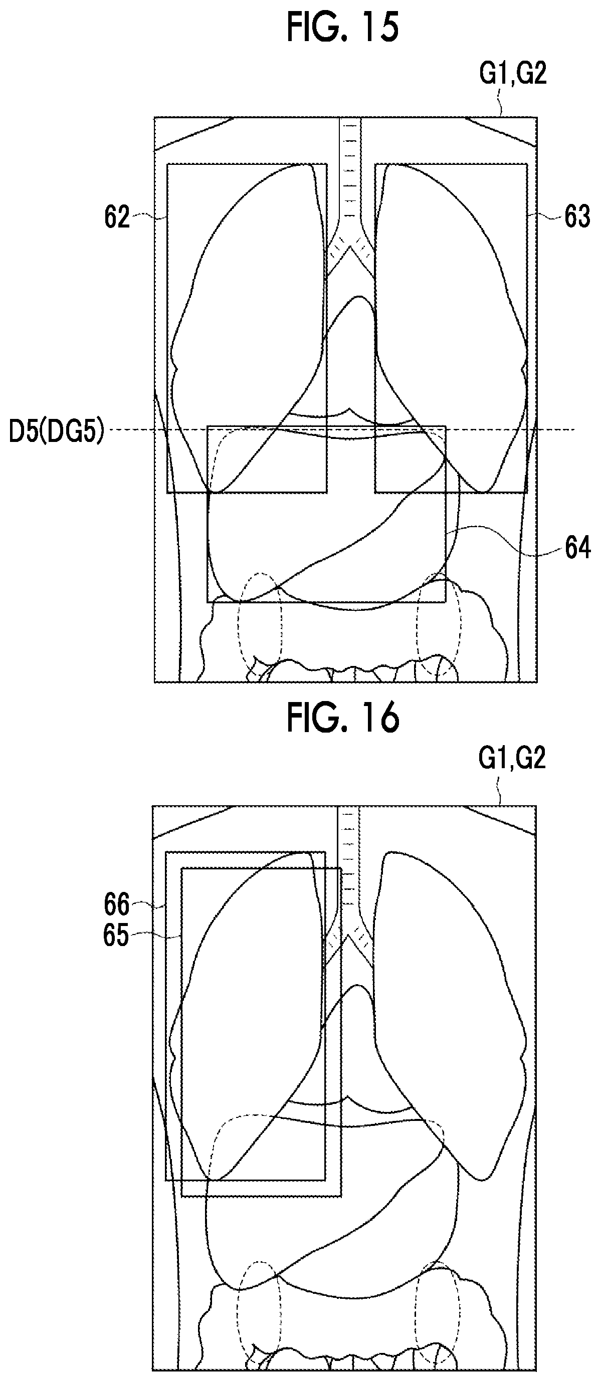 Patent US12488479 Figure 10 – Image alignment apparatus, method, and program