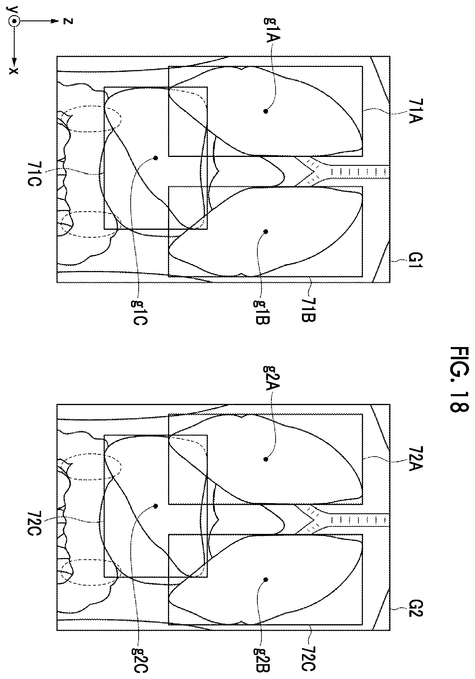 Patent US12488479 Figure 12 – Image alignment apparatus, method, and program