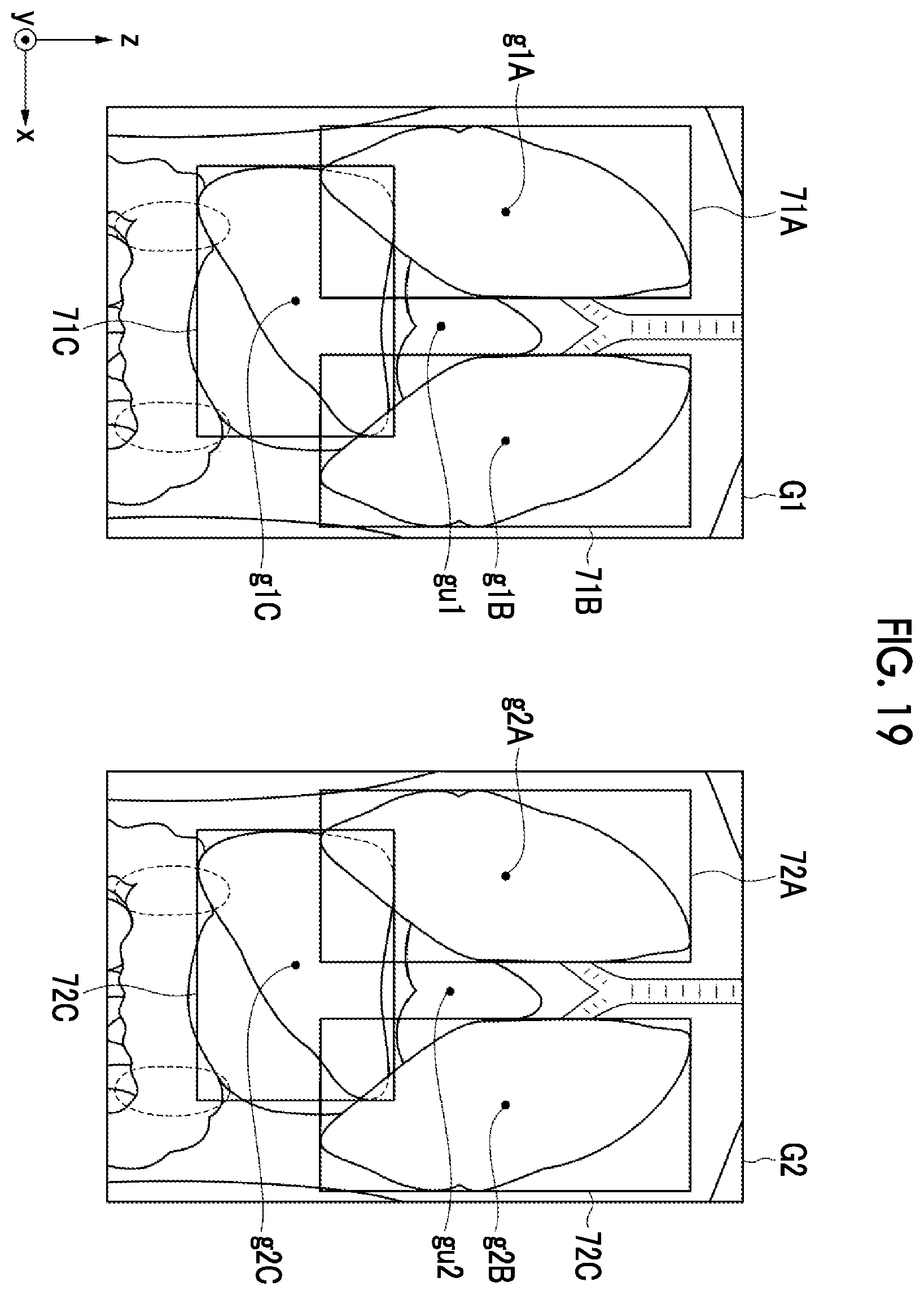 Patent US12488479 Figure 13 – Image alignment apparatus, method, and program