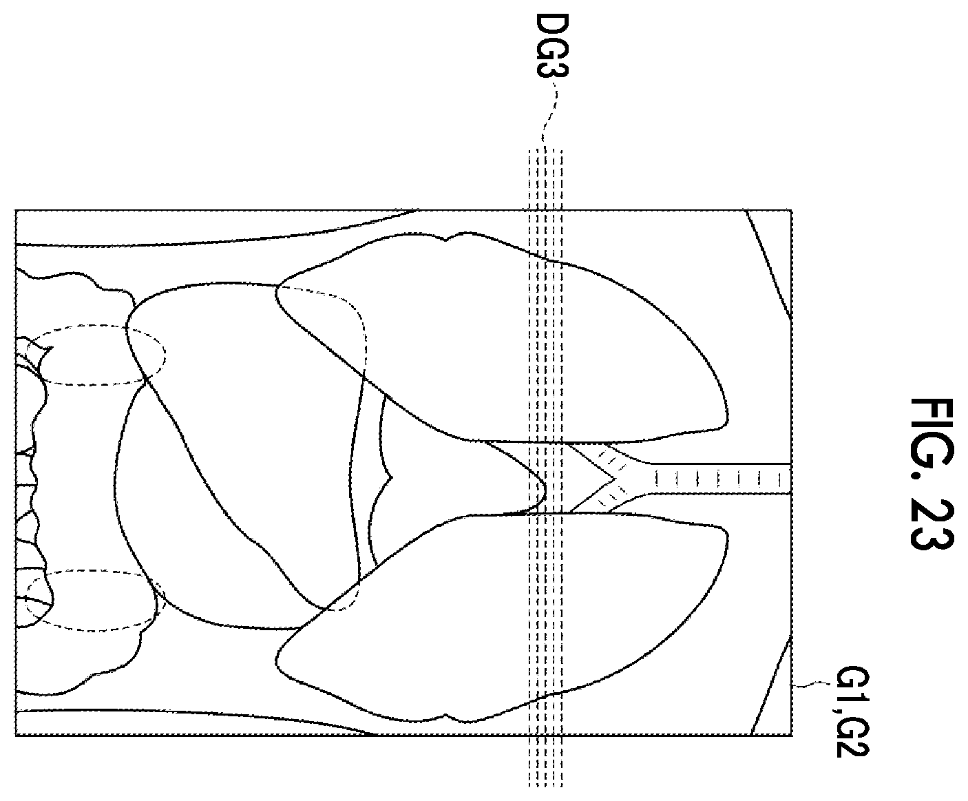 Patent US12488479 Figure 16 – Image alignment apparatus, method, and program