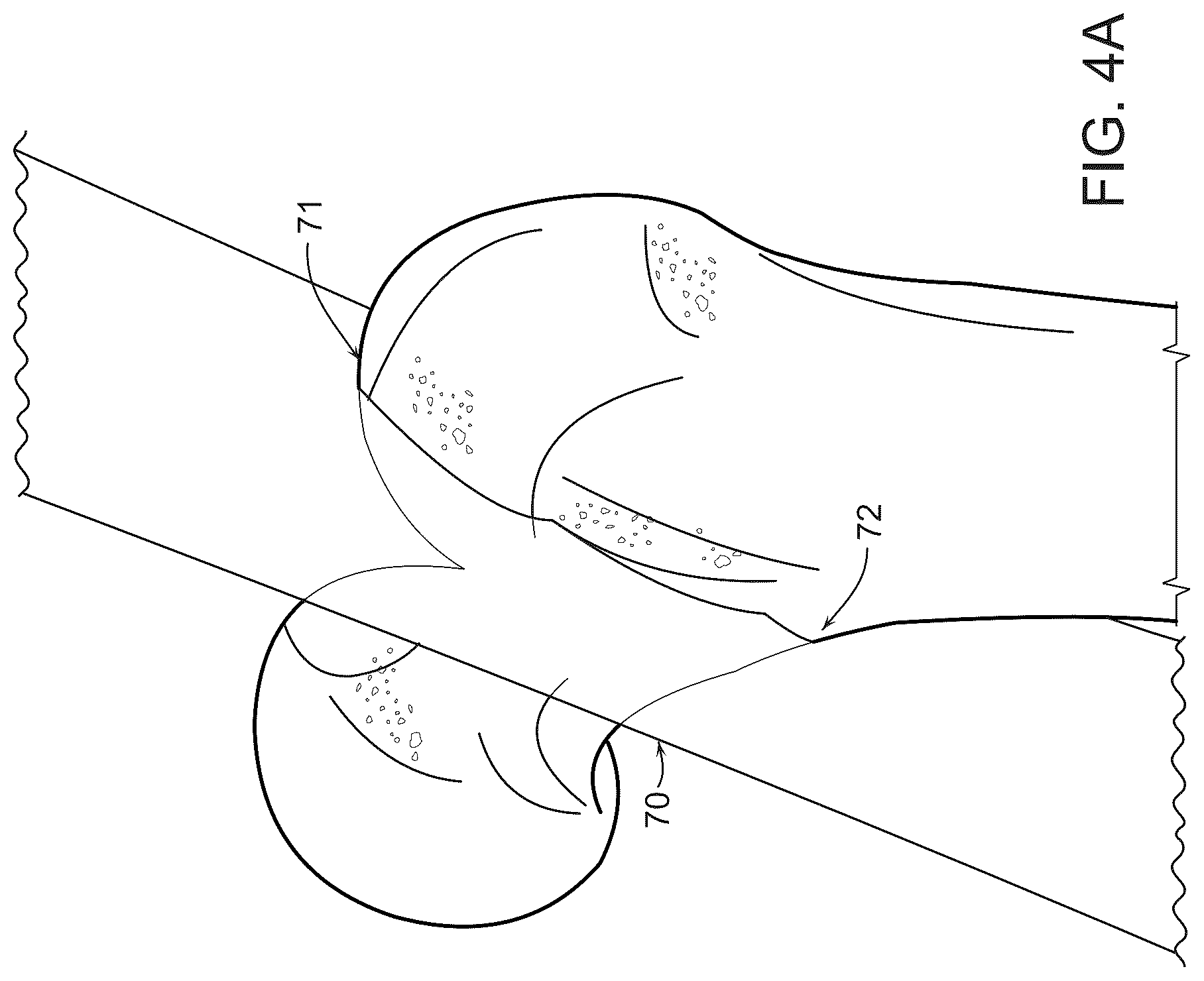 Patent US12488480 Figure 4 – Augmented reality guidance for surgical procedures