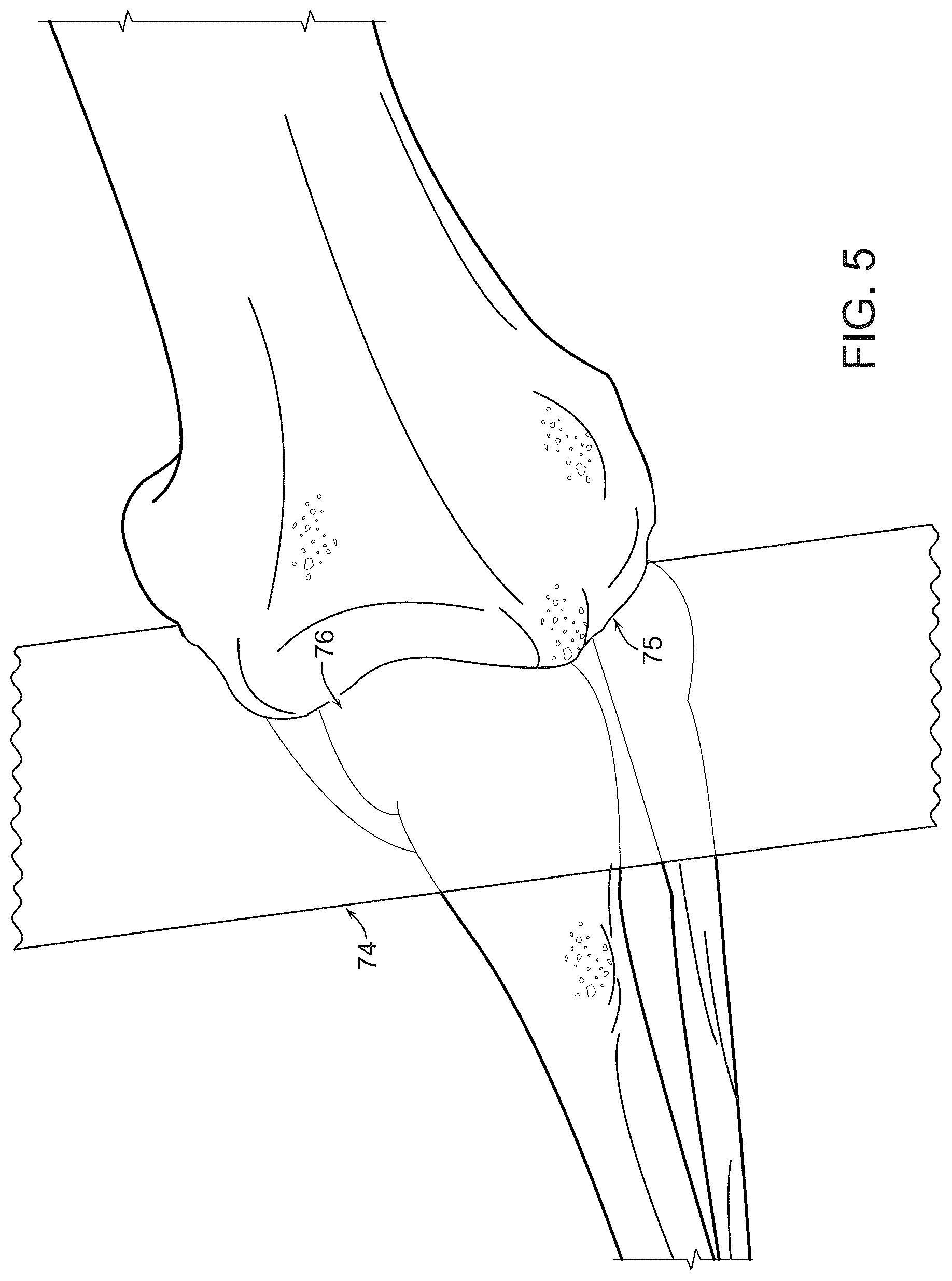 Patent US12488480 Figure 7 – Augmented reality guidance for surgical procedures