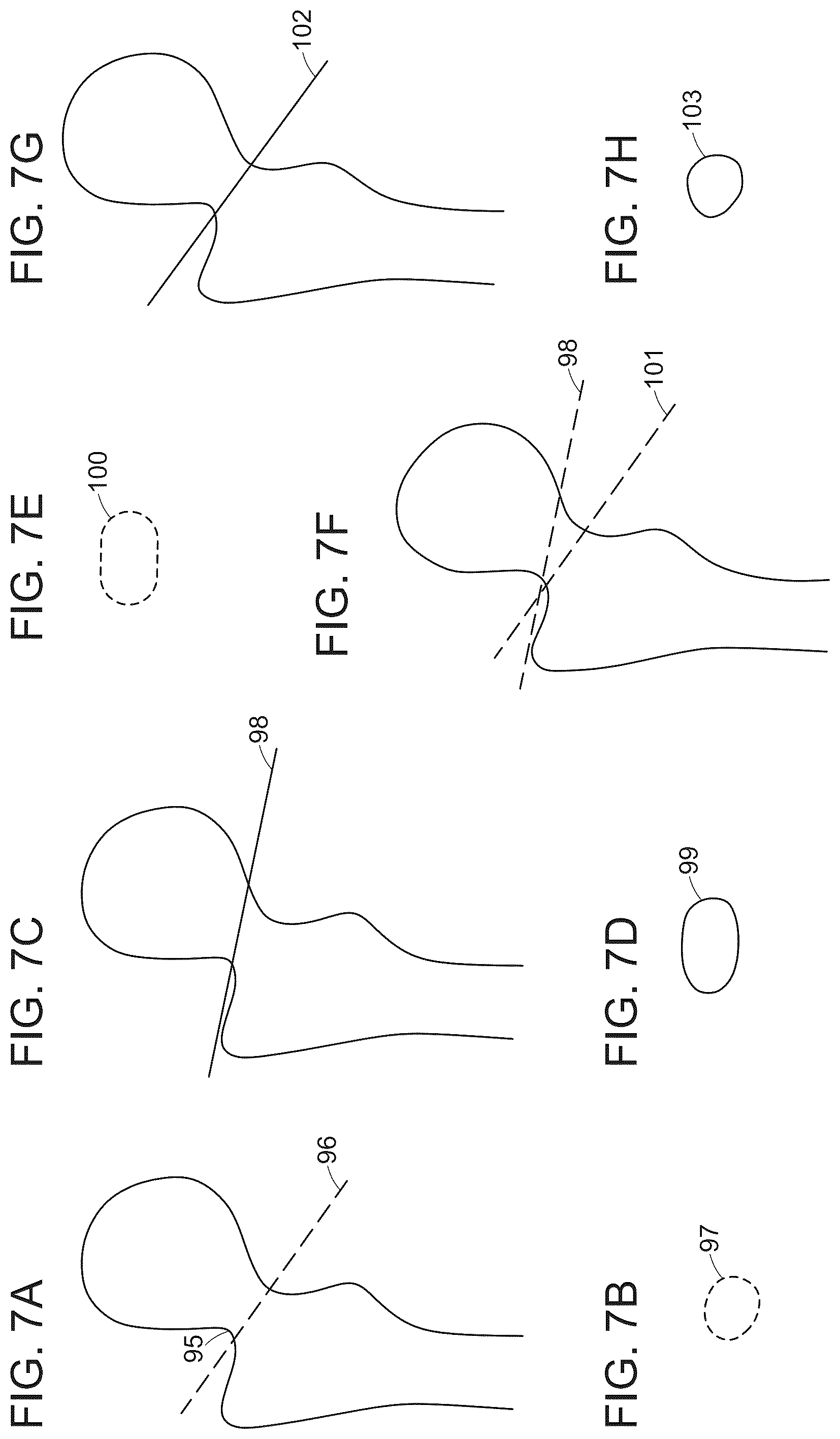 Patent US12488480 Figure 9 – Augmented reality guidance for surgical procedures
