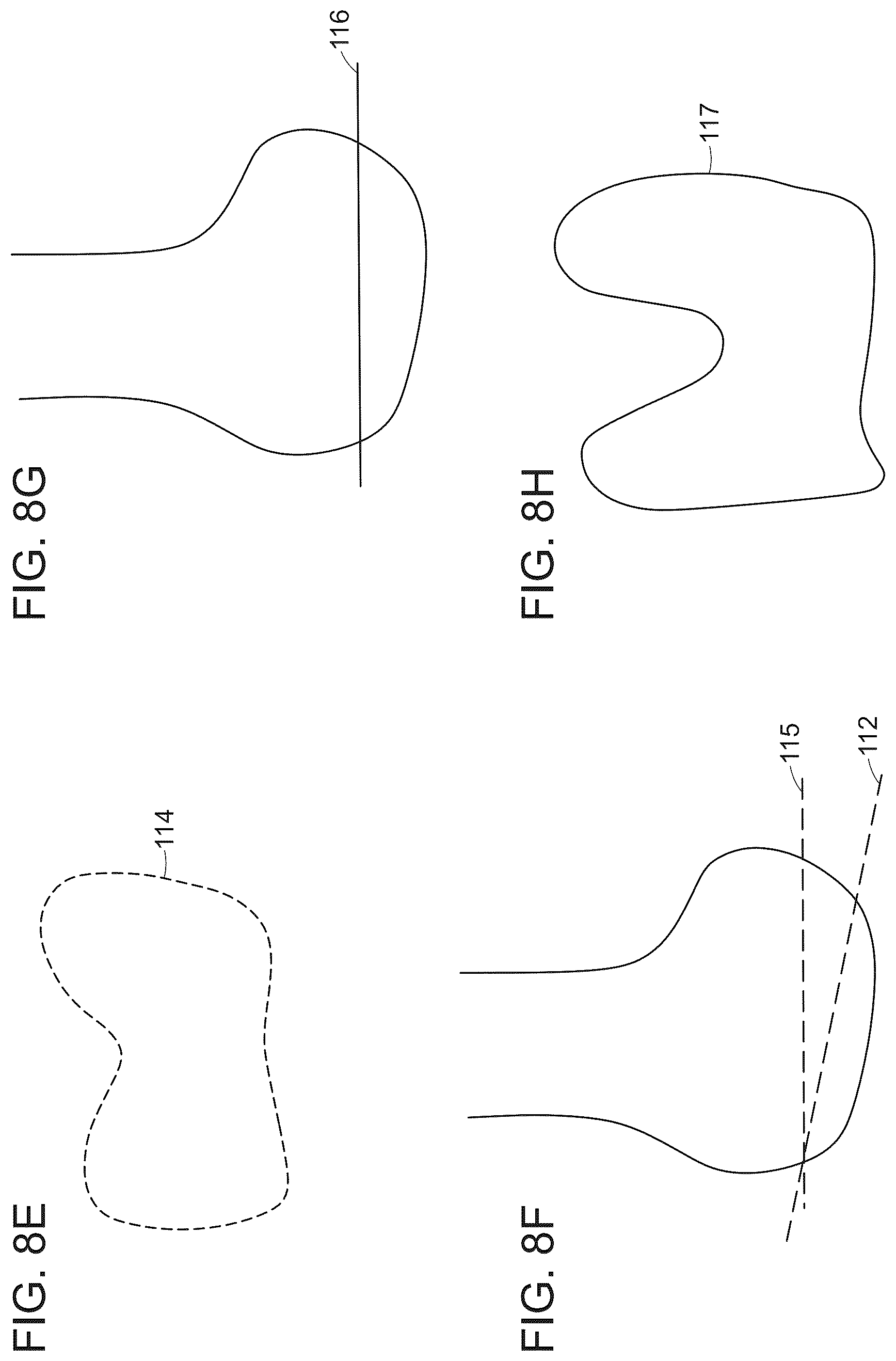 Patent US12488480 Figure 11 – Augmented reality guidance for surgical procedures