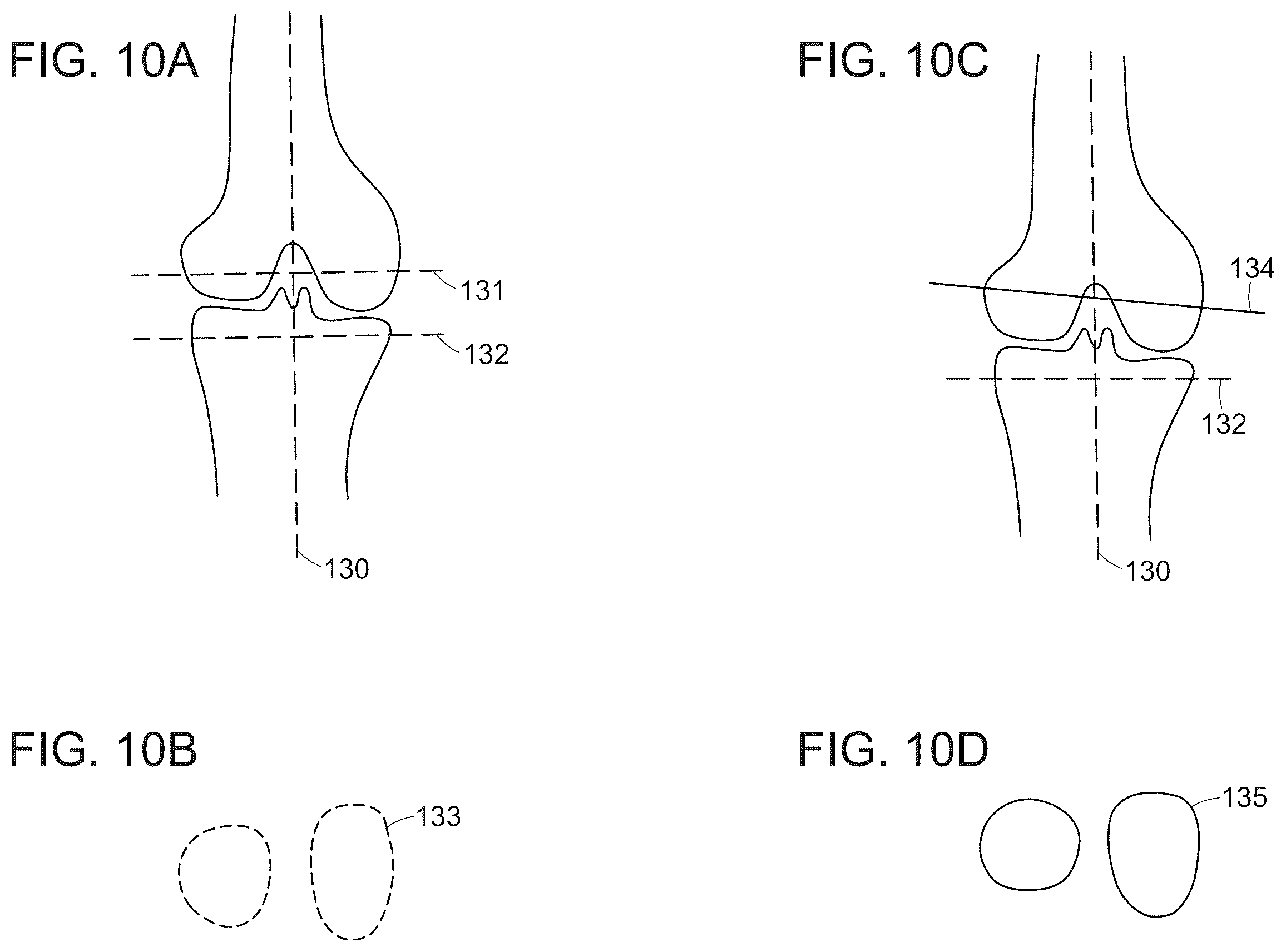 Patent US12488480 Figure 14 – Augmented reality guidance for surgical procedures